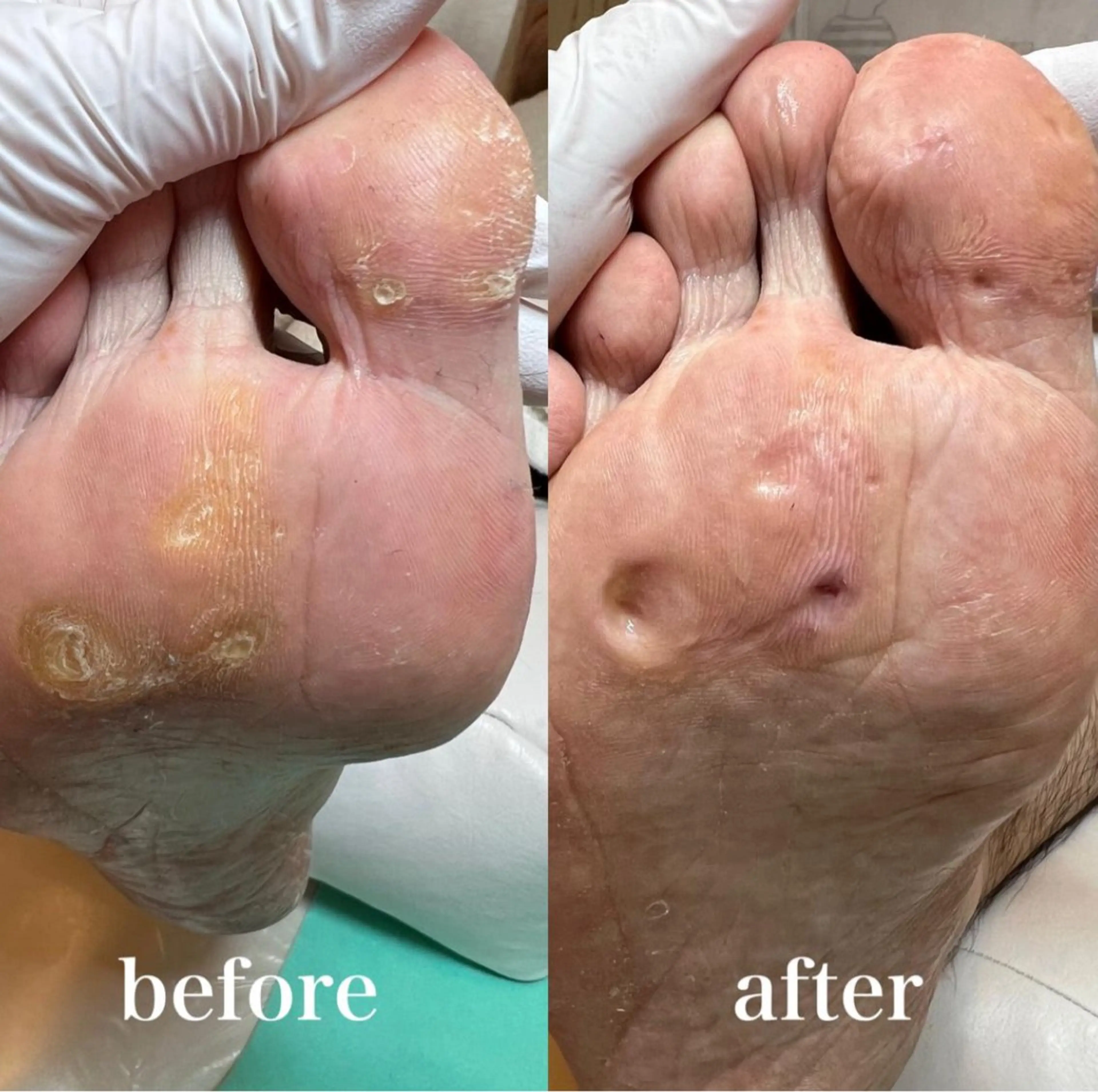 リラク 福岡巻き爪補正店 博多店のエステ・リラクイメージ