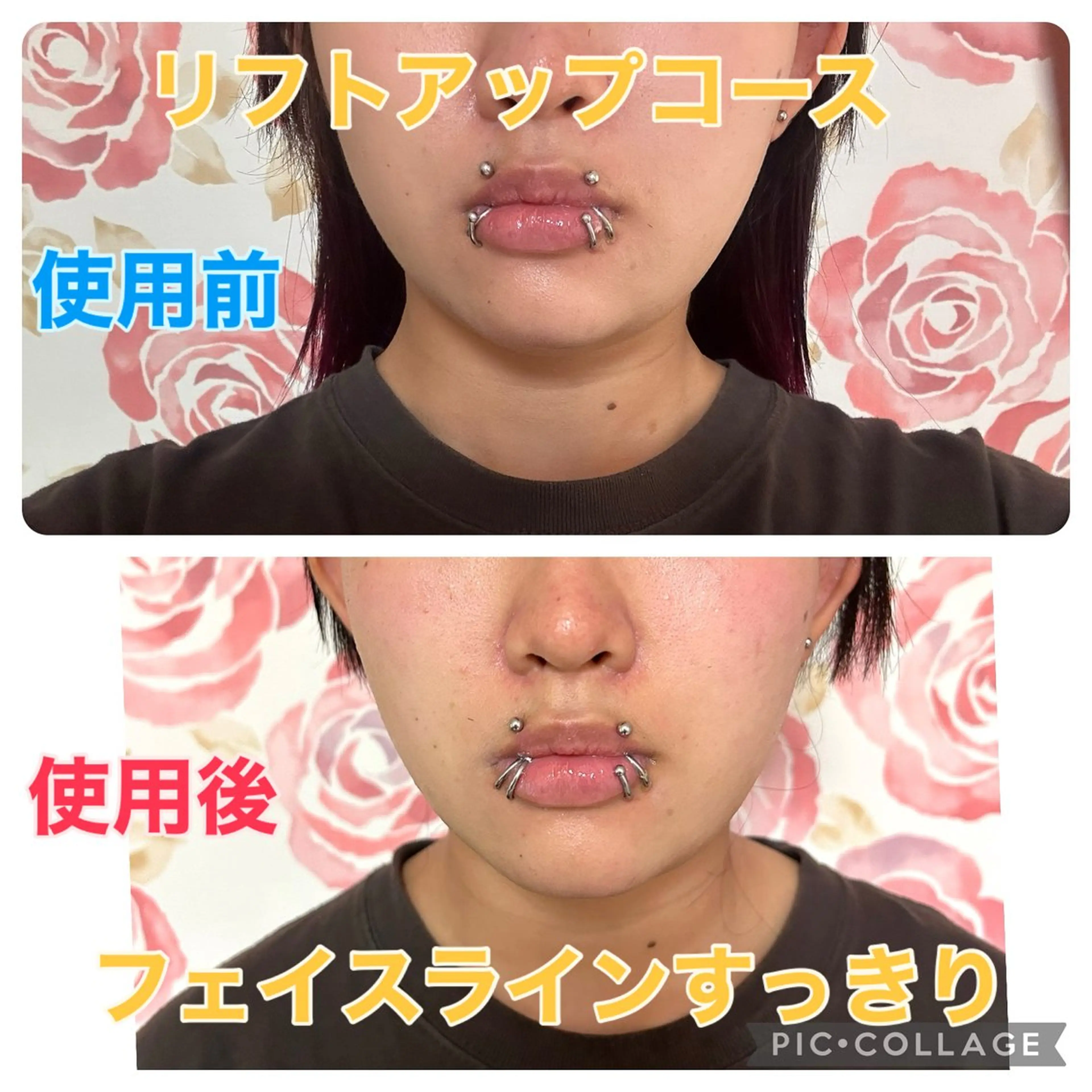 リフトアップコース（フェイスラインすっきり目元ハッキリ）むくみやすい方、痩せてみえたい方オススメの写真