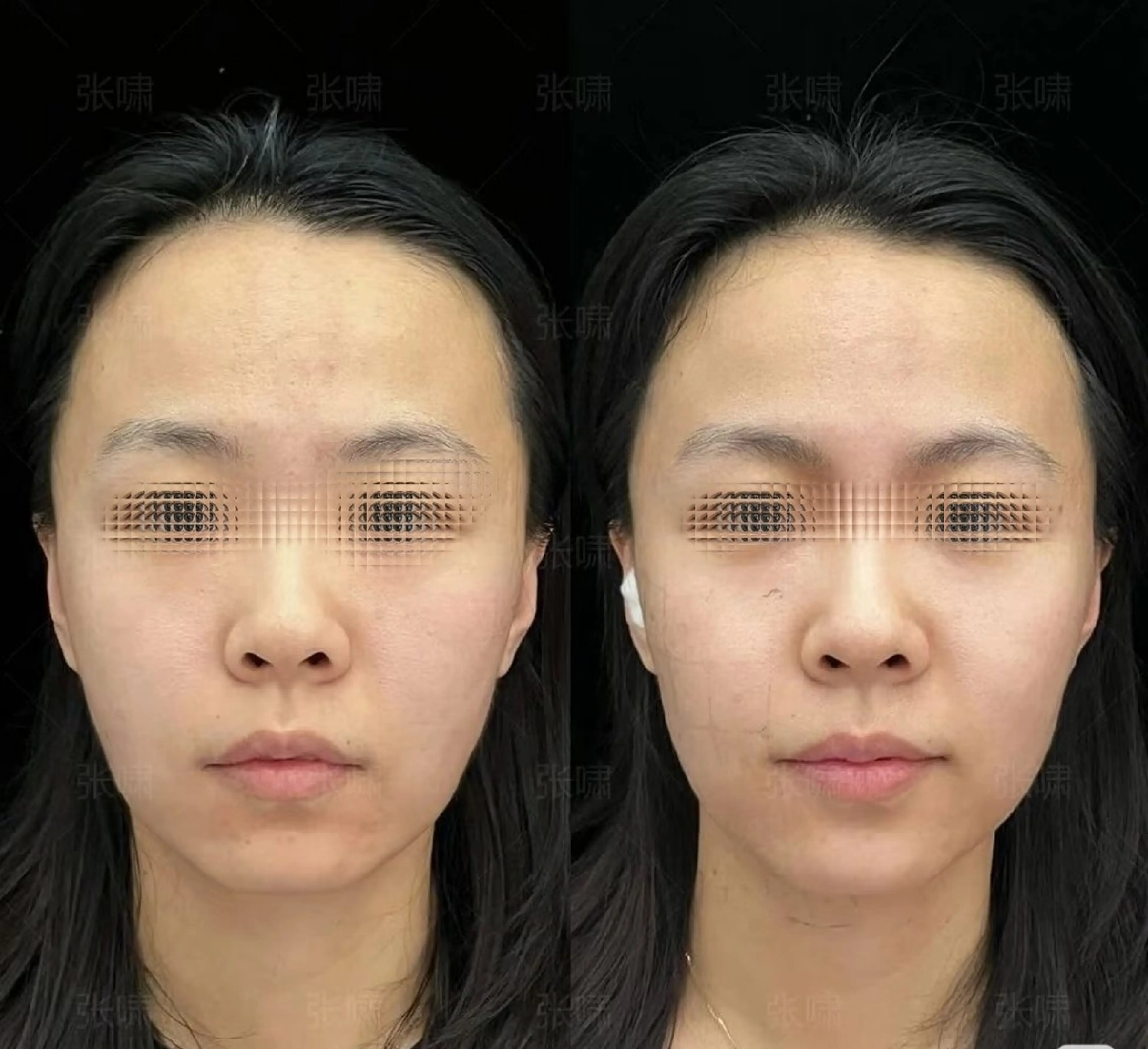 マツエク・マツパ 結婚式・ブライダル aliaハーブ水光店 エステティシャン募集のエステ・リラクイメージ