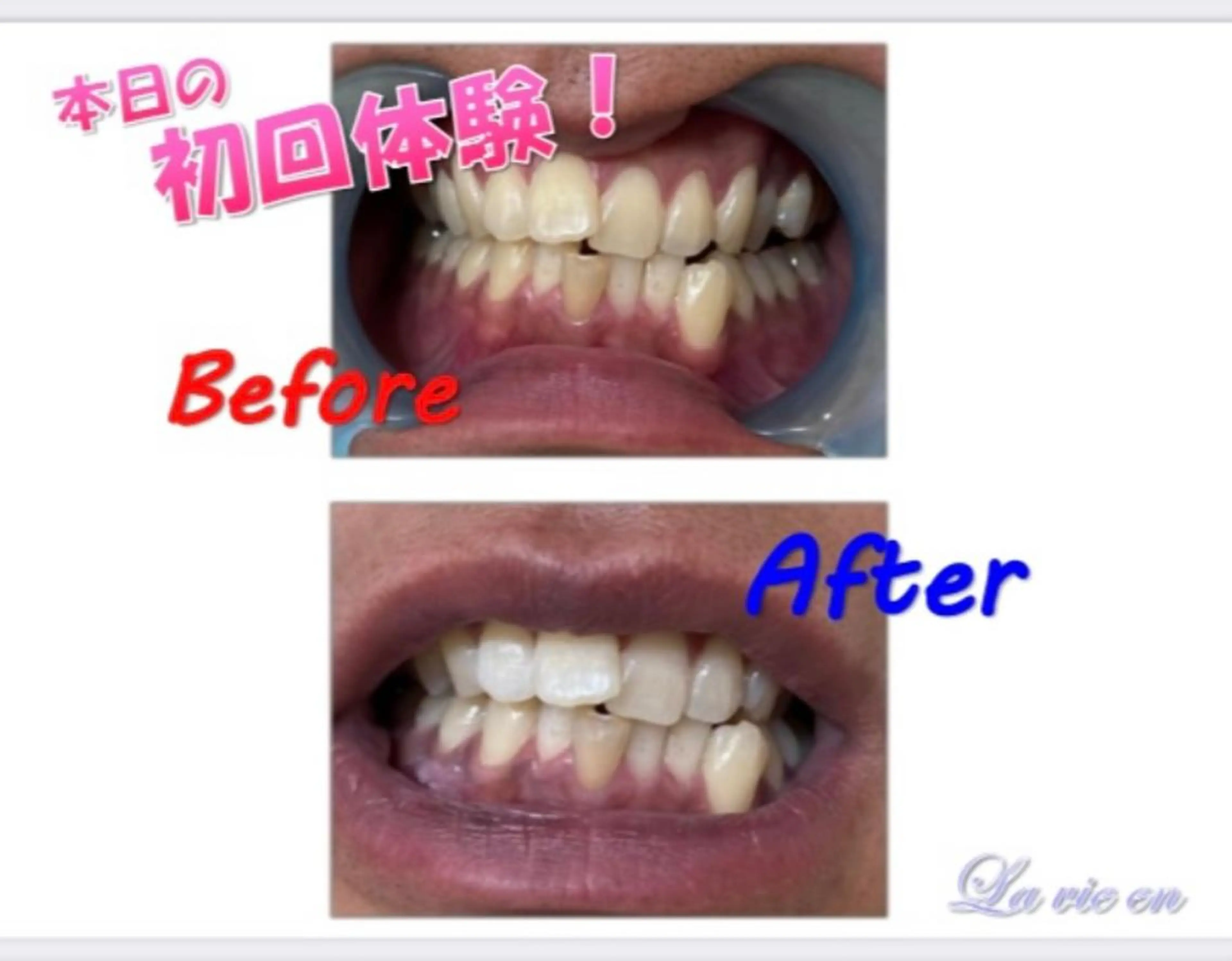 その他 セルフホワイトニングサロン　ラヴィアン所属・ホワイトニングサロン La vie enのその他イメージ