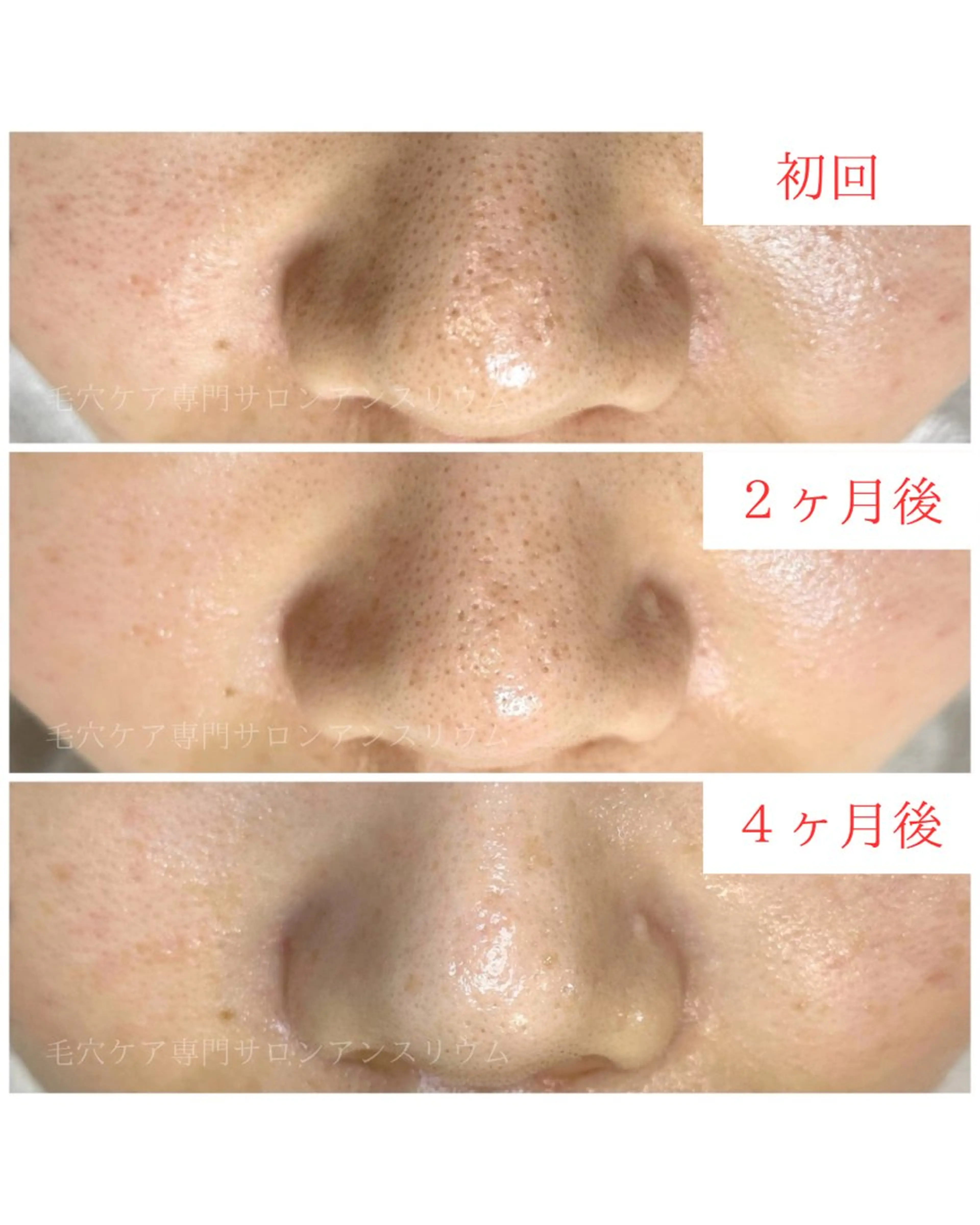 茨城土浦 つくば毛穴 ケア専門サロンのエステ・リラクイメージ