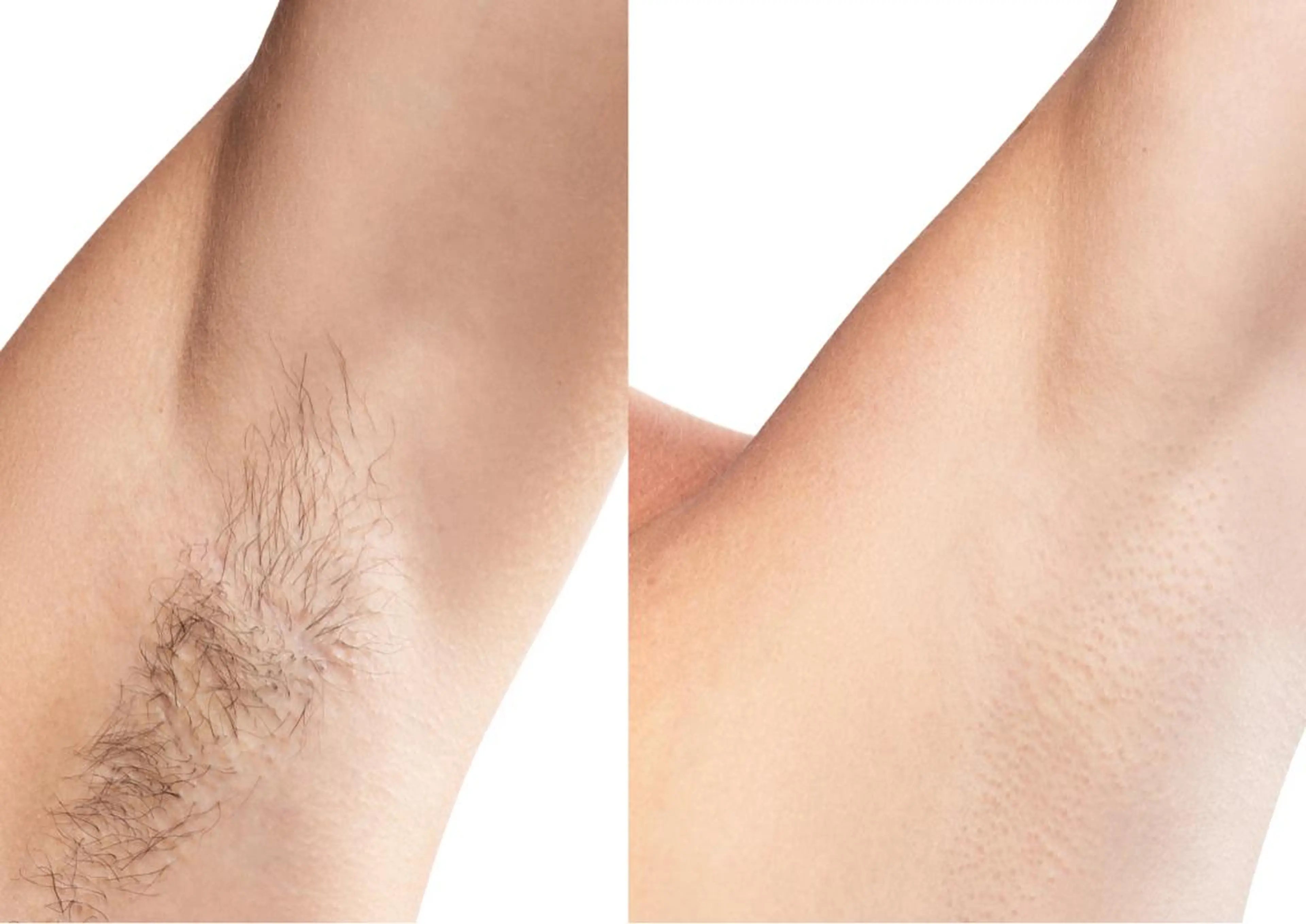 全身脱毛/韓国ツヤ肌 ハーブピーリングのエステ・リラクイメージ