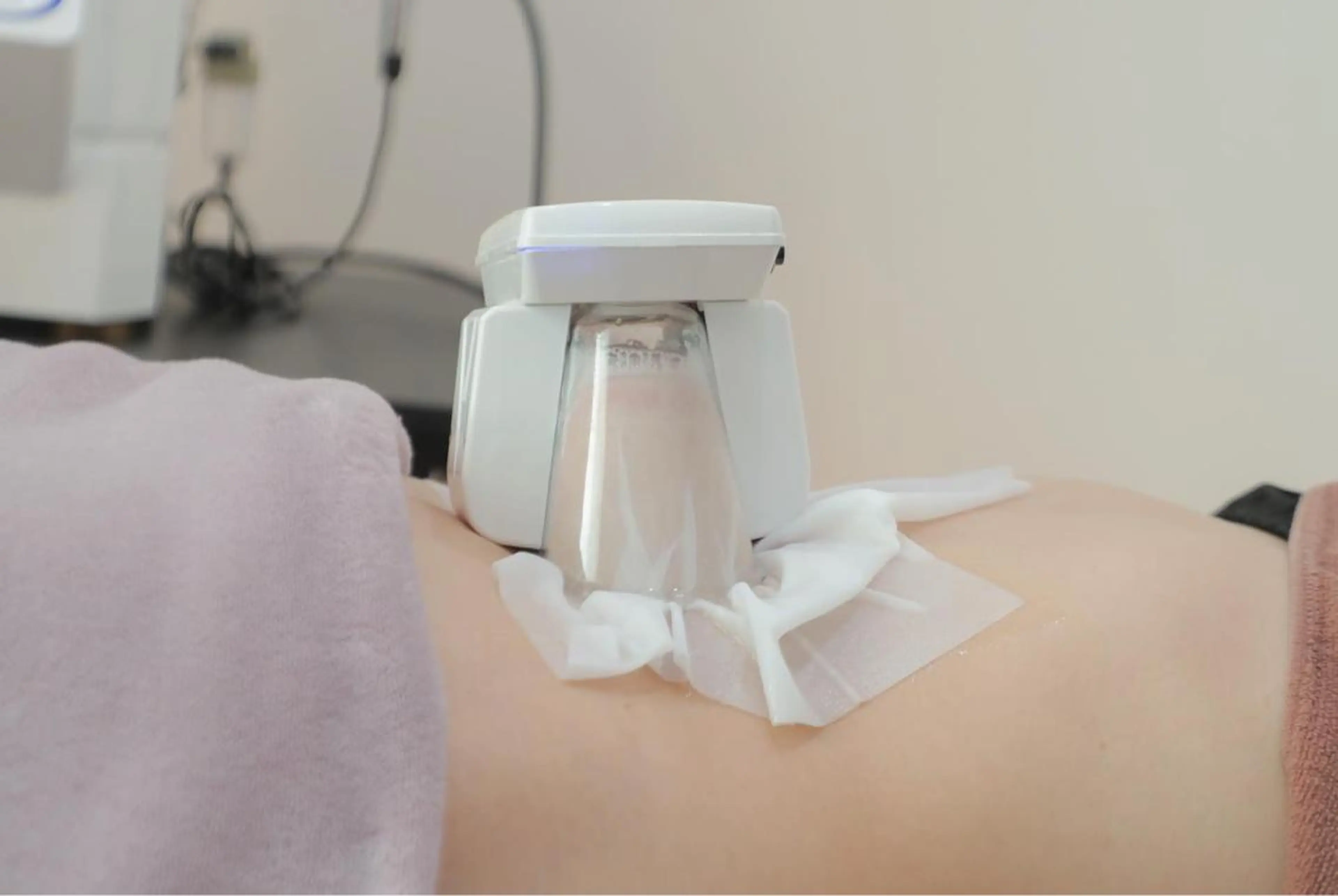 冷却2カップお試し10000円の写真