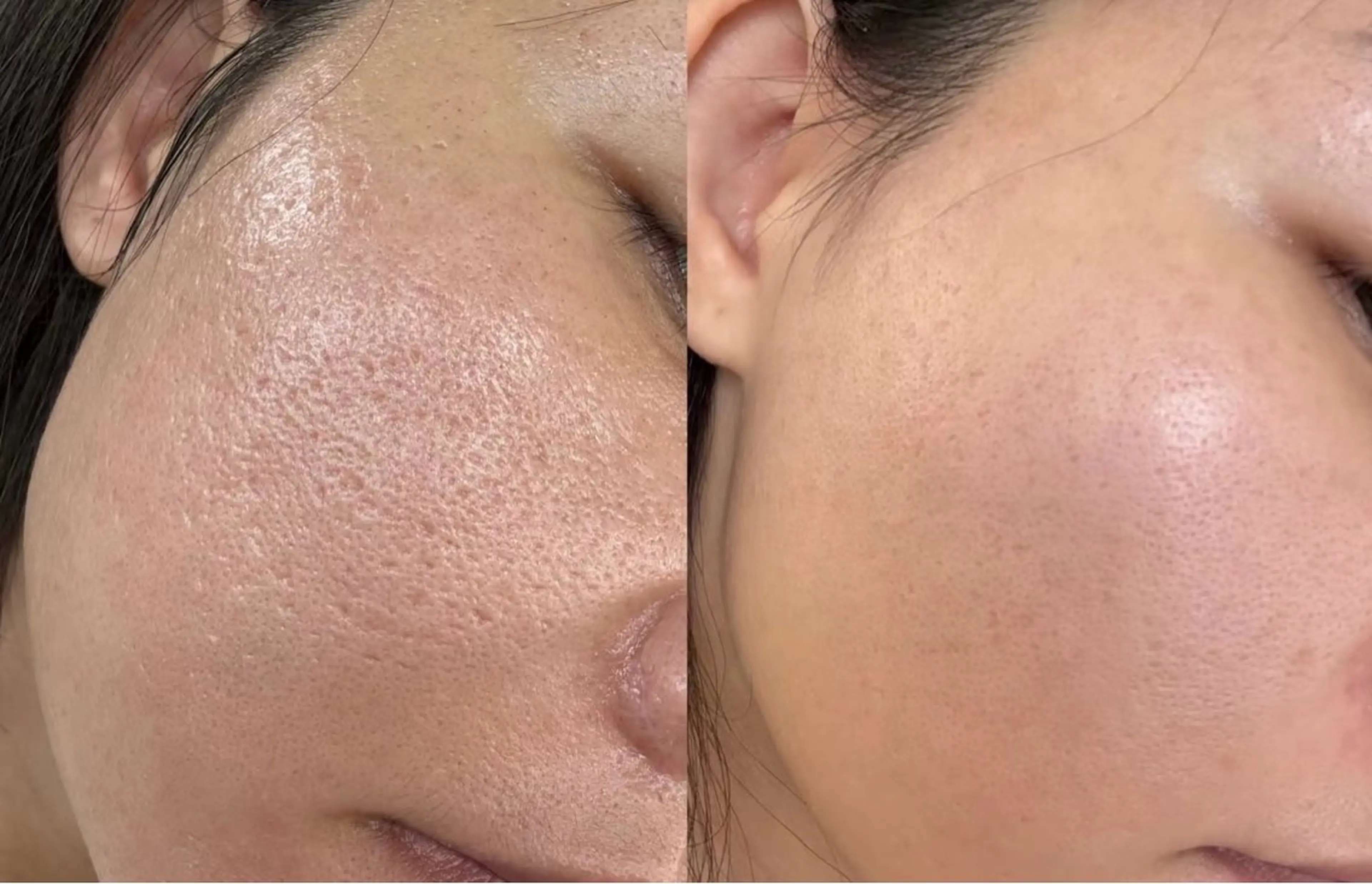 パーマ エステ リラク 愛維美水光美肌専門店所属・愛維美水光美肌専門店 メンズレディースokのエステ・リラクイメージ