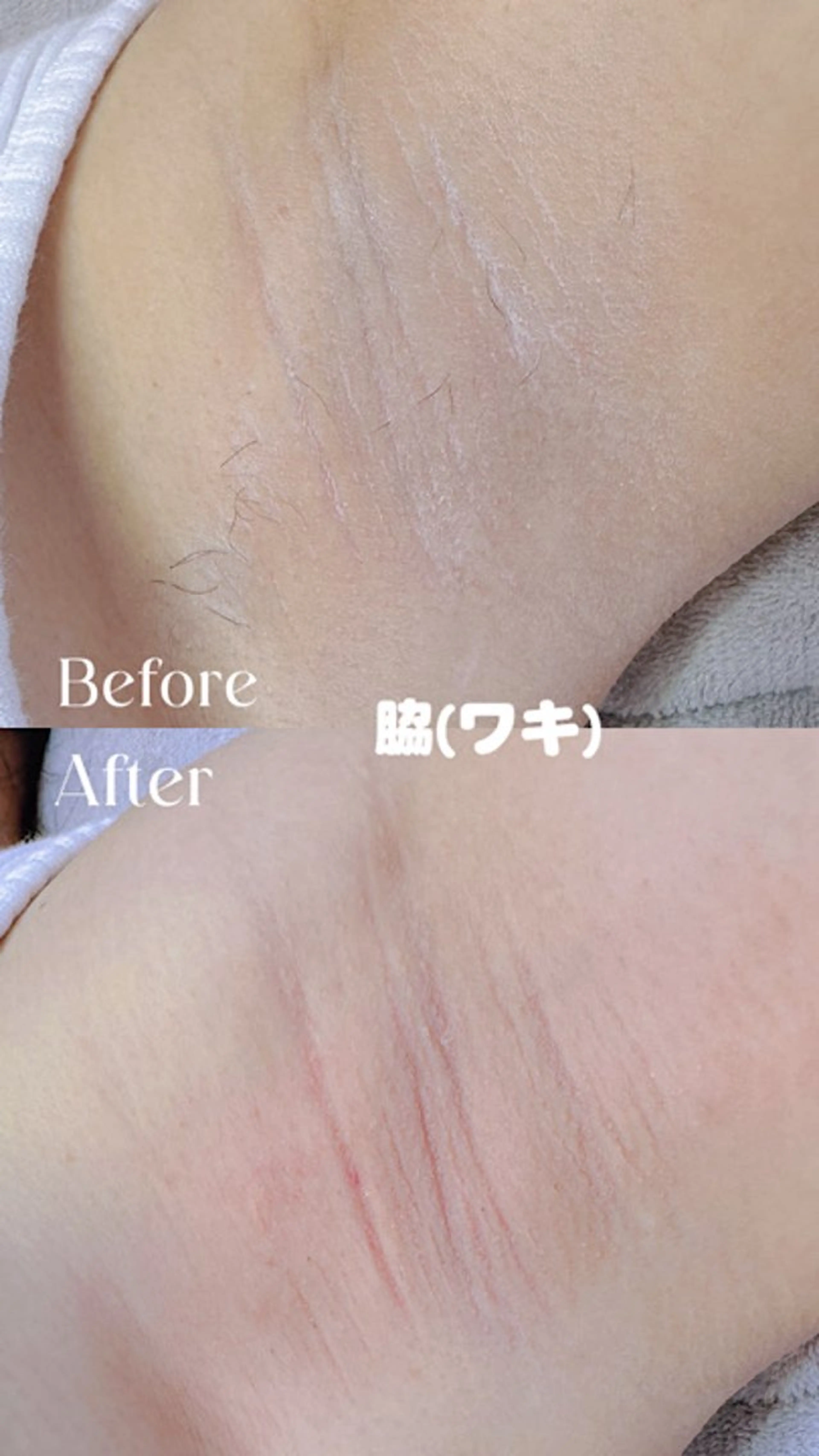 Hitomi シュガーリング豊橋のその他イメージ