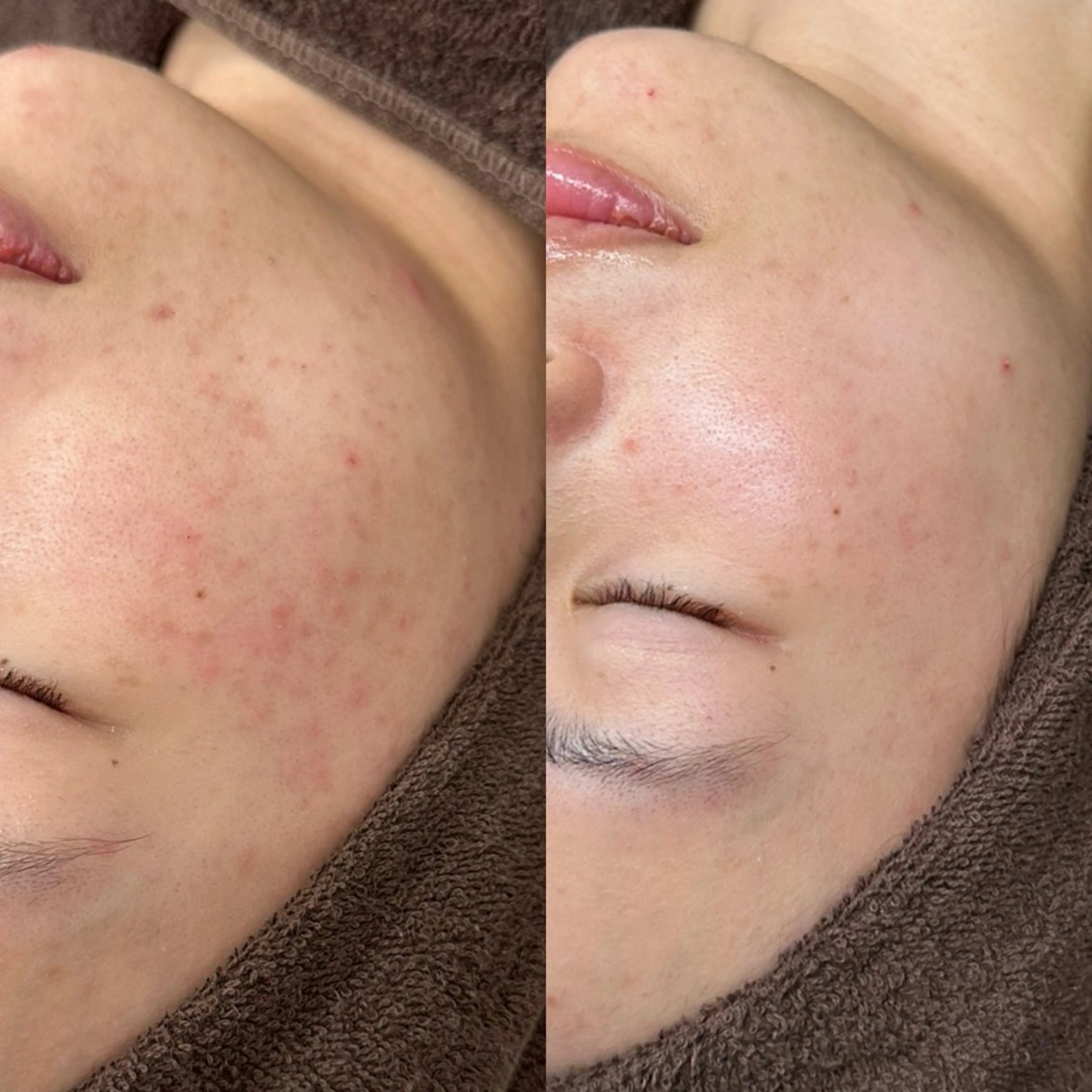 エステ 高知駅前店　Tug AMIのその他イメージ