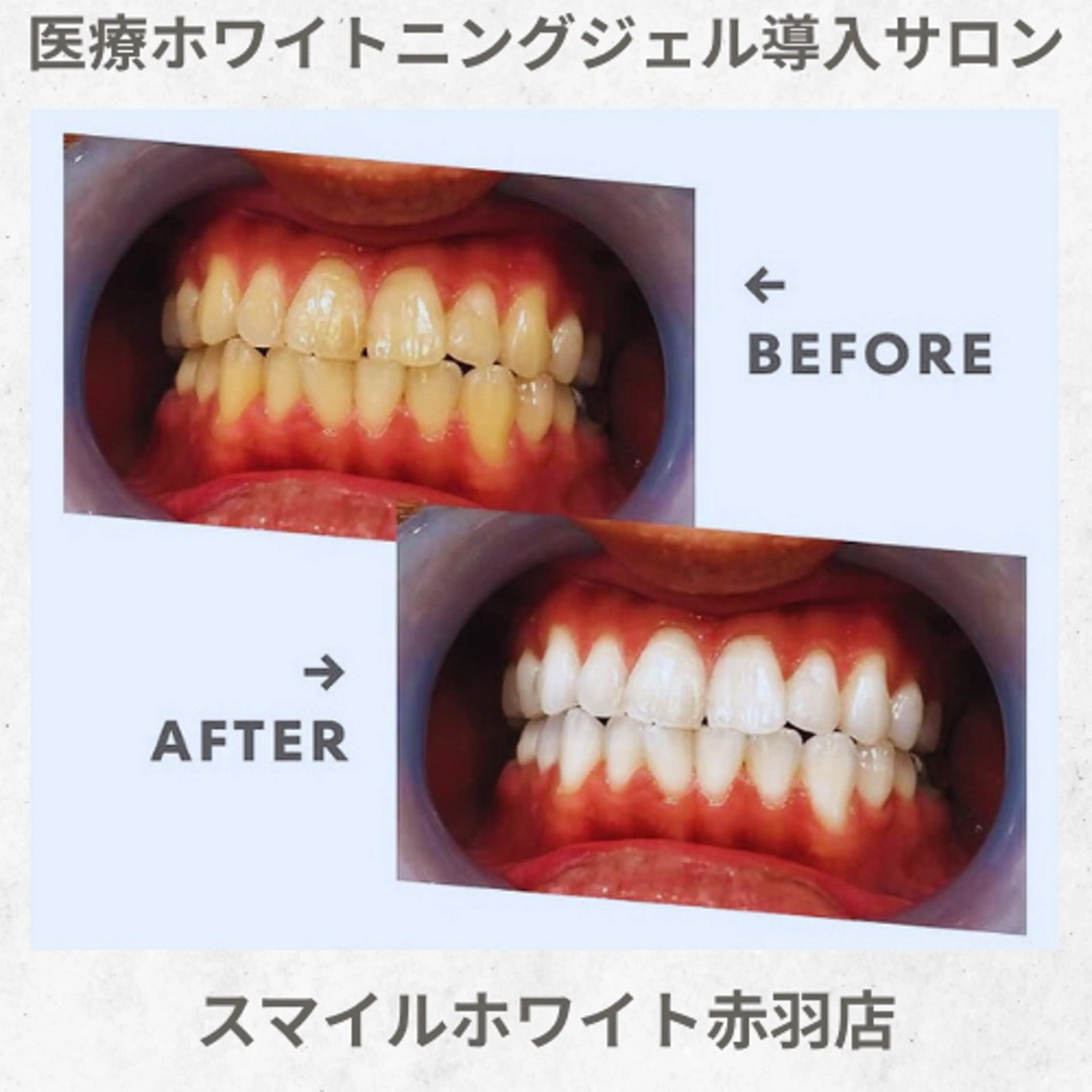 ヘアアレンジ スマイルホワイト 赤羽店のエステ・リラクイメージ