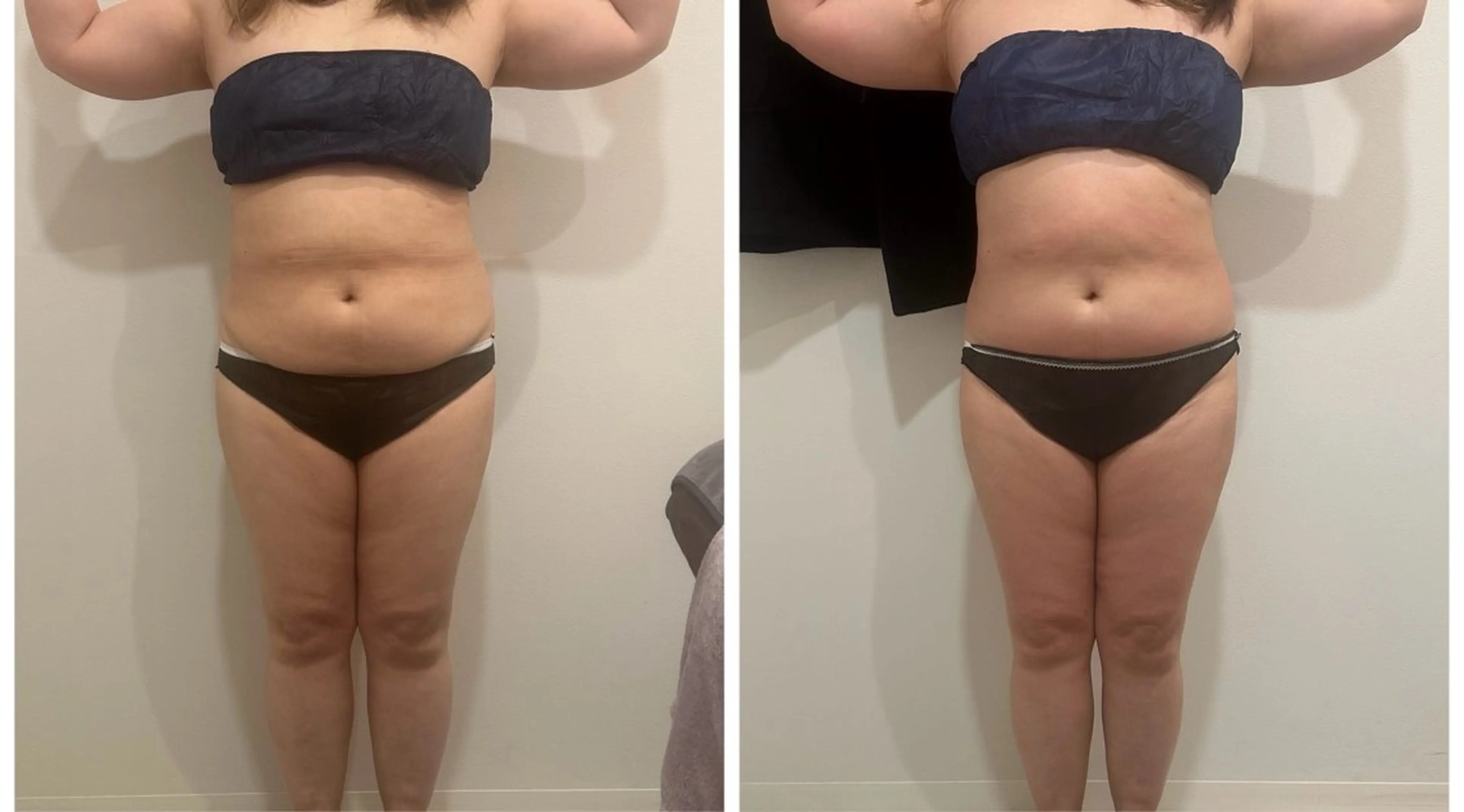 エステ 桜新町 Sakurakoの眉毛・アイブロウイメージ