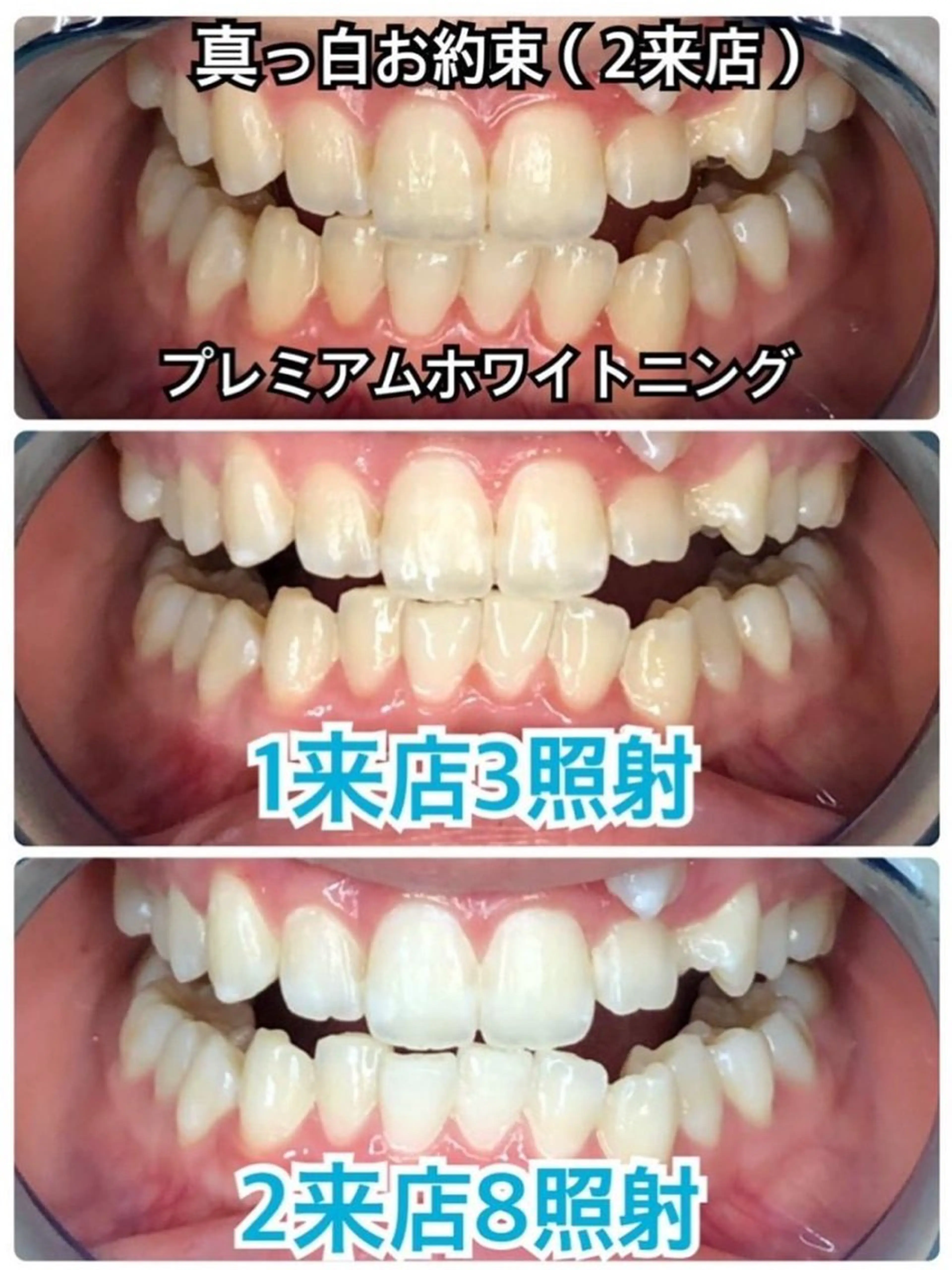 その他 ☆専門店にお任せ☆ ホワイトニング吉祥寺のその他イメージ