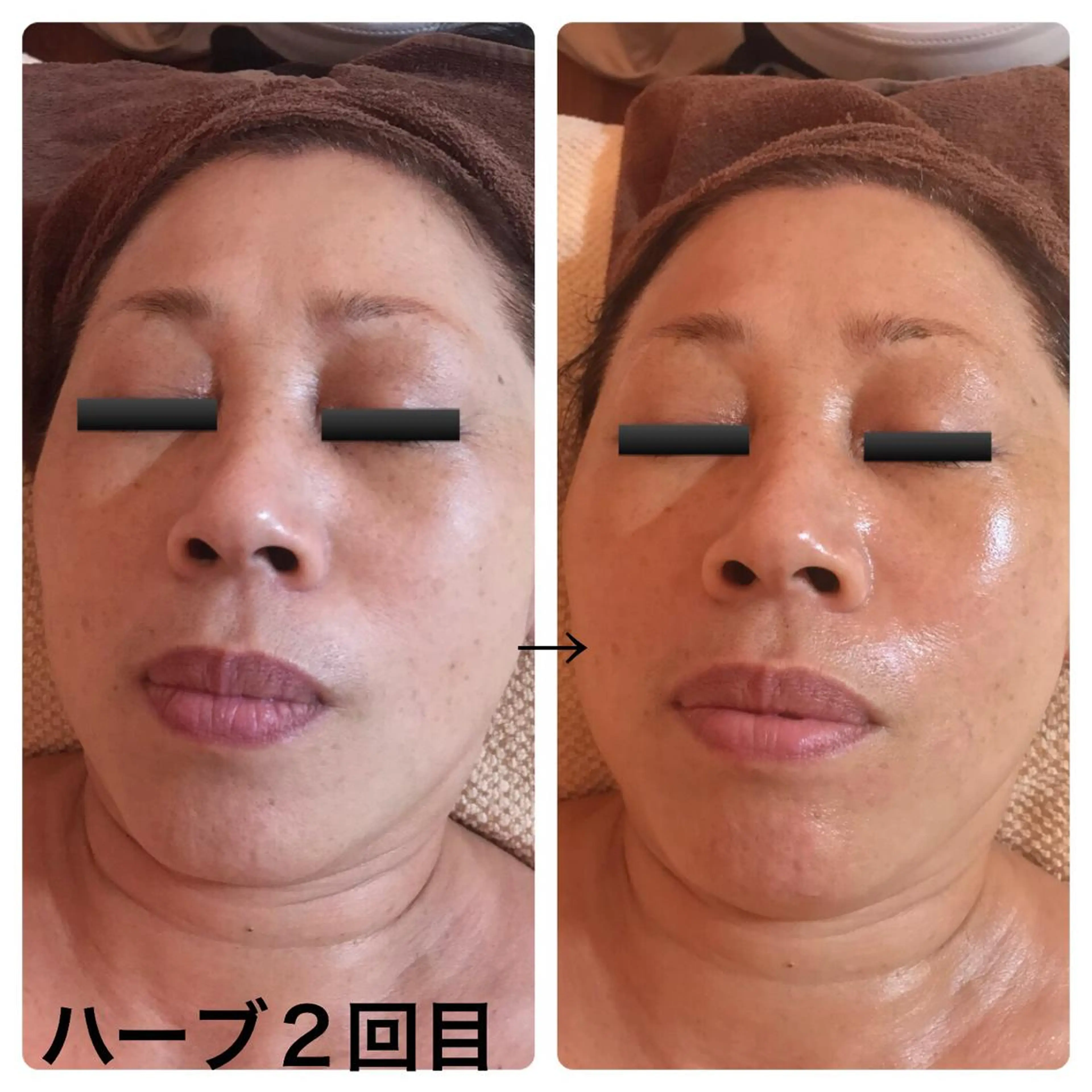 fairyrose organicエステのエステ・リラクイメージ