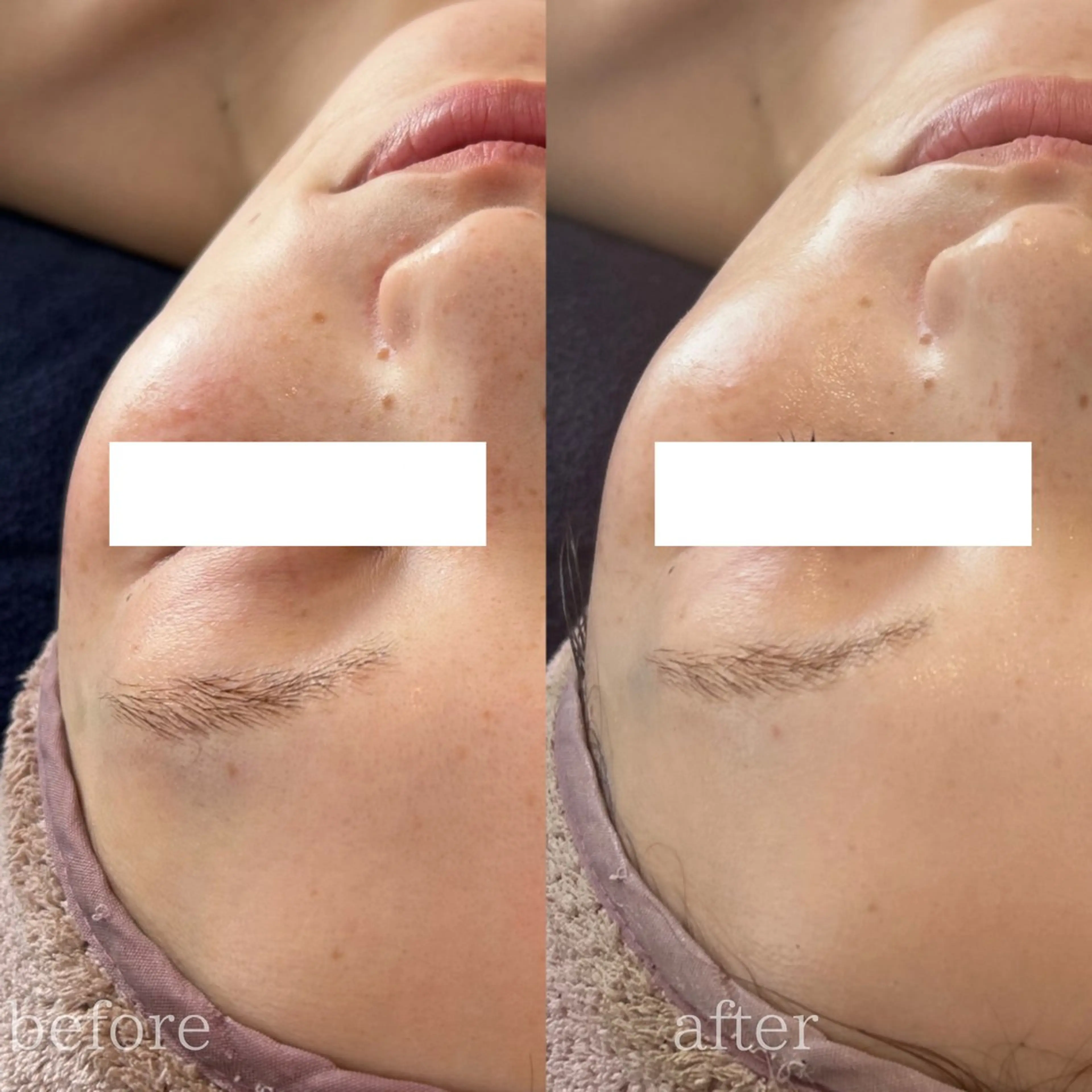 Le cherienのエステ・リラクイメージ