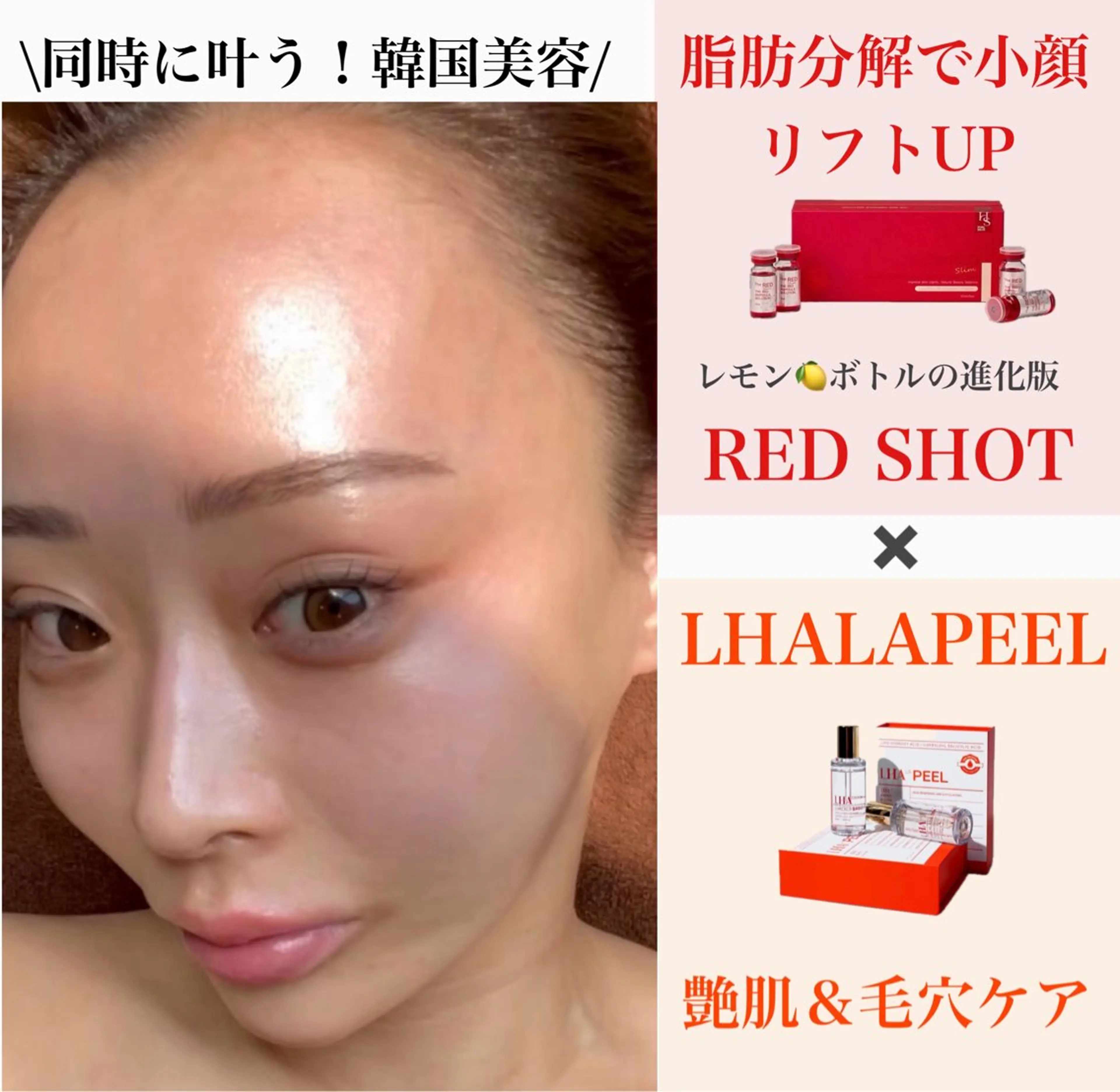 小顔と艶肌同時に叶う韓国美容【レッドショット🔥&ララピール 】¥21700→¥13000の写真