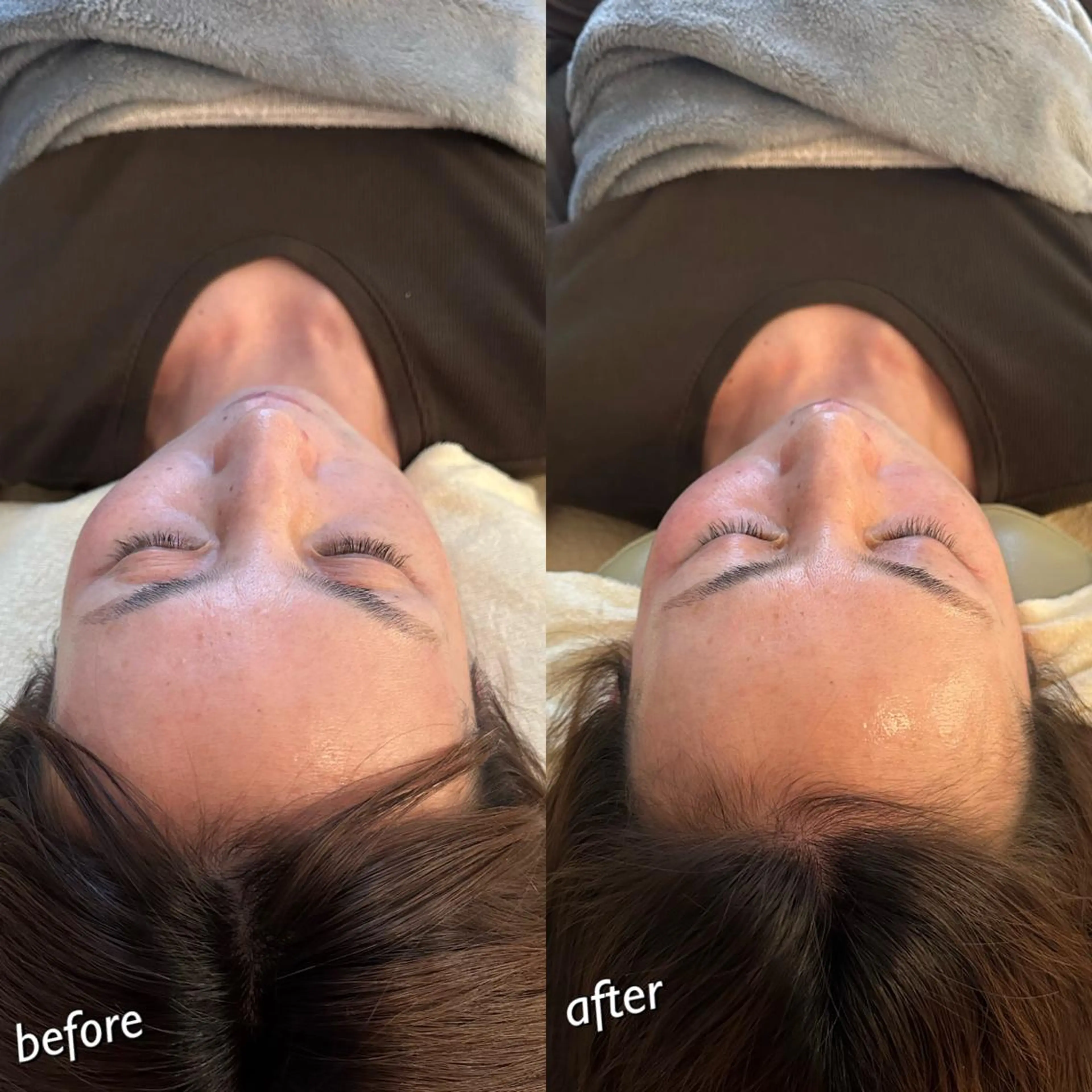 うなじ脱毛/美肌脱毛 LABELのエステ・リラクイメージ