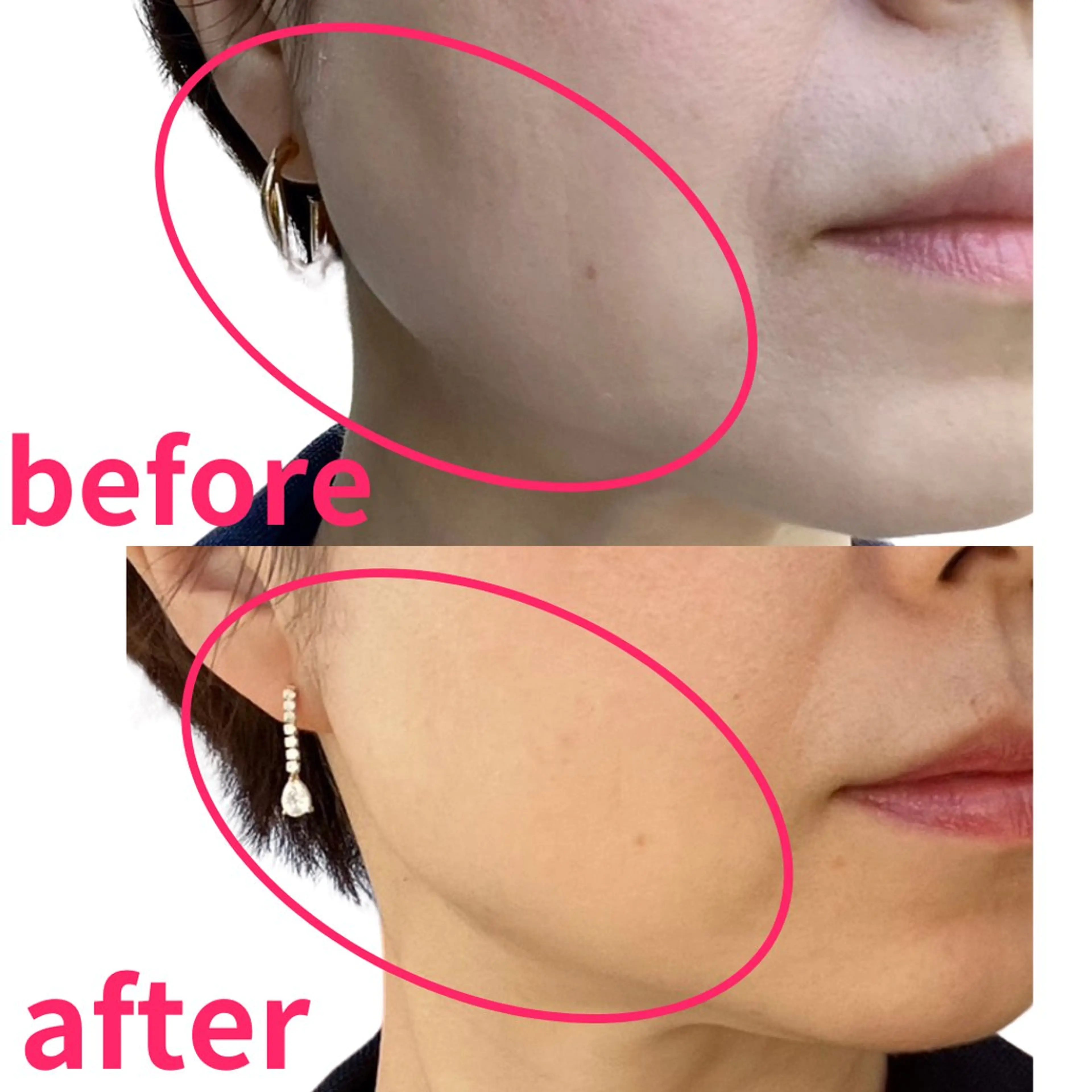 POLA 北花田店のエステ・リラクイメージ