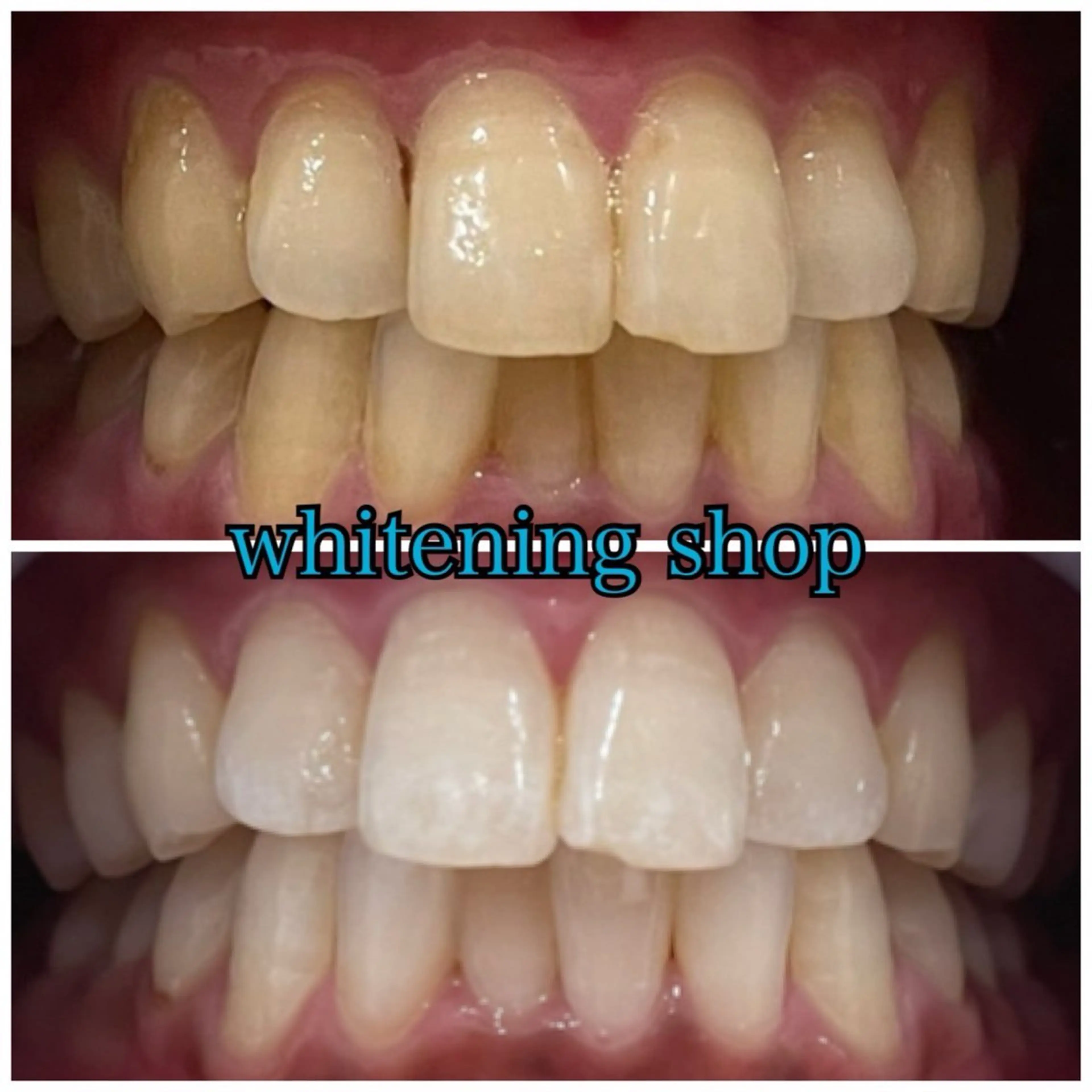 メンズ ホワイトニング ショップ川越店のエステ・リラクイメージ