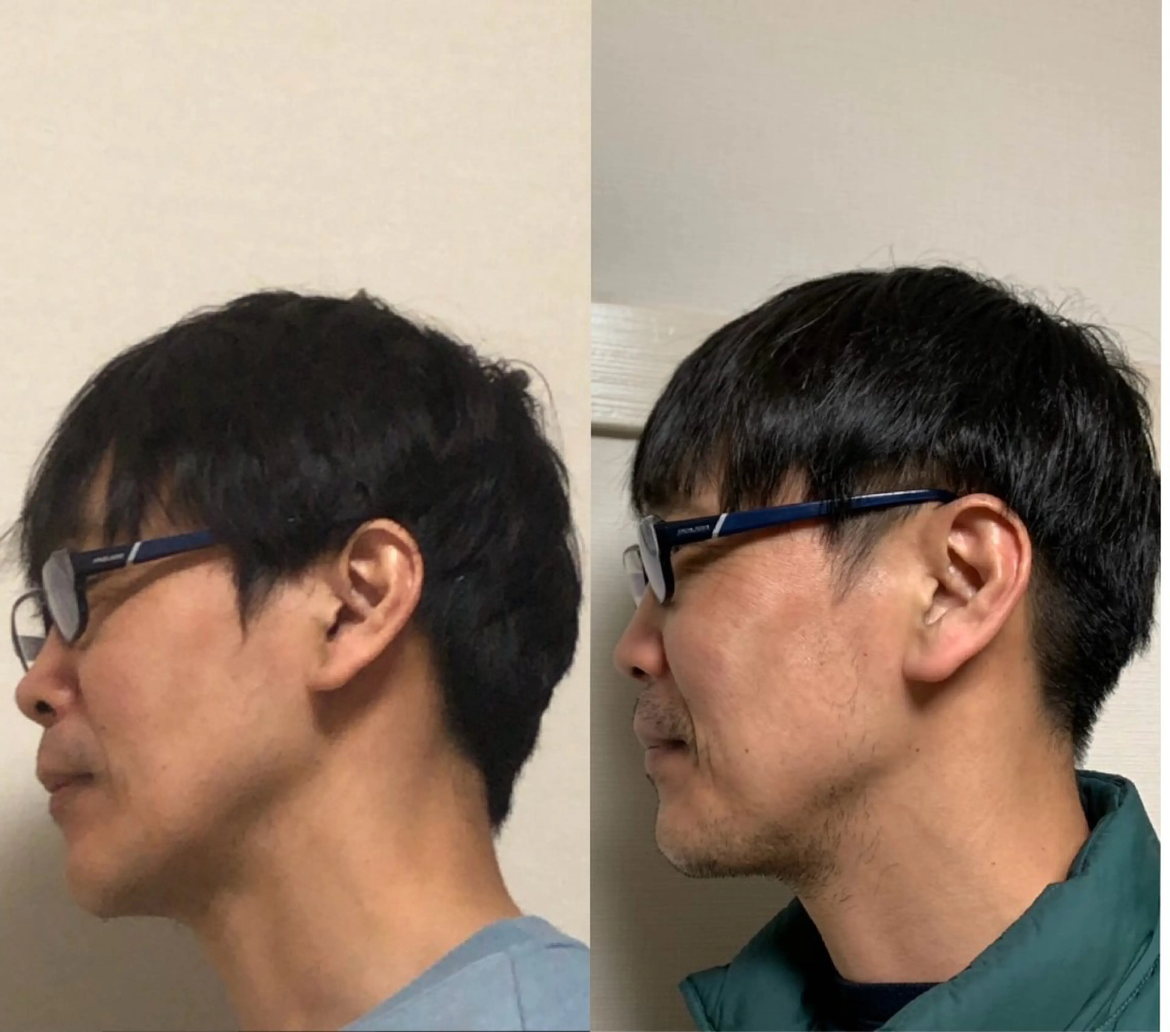 ショート 宇野井 勝太のヘアスタイル