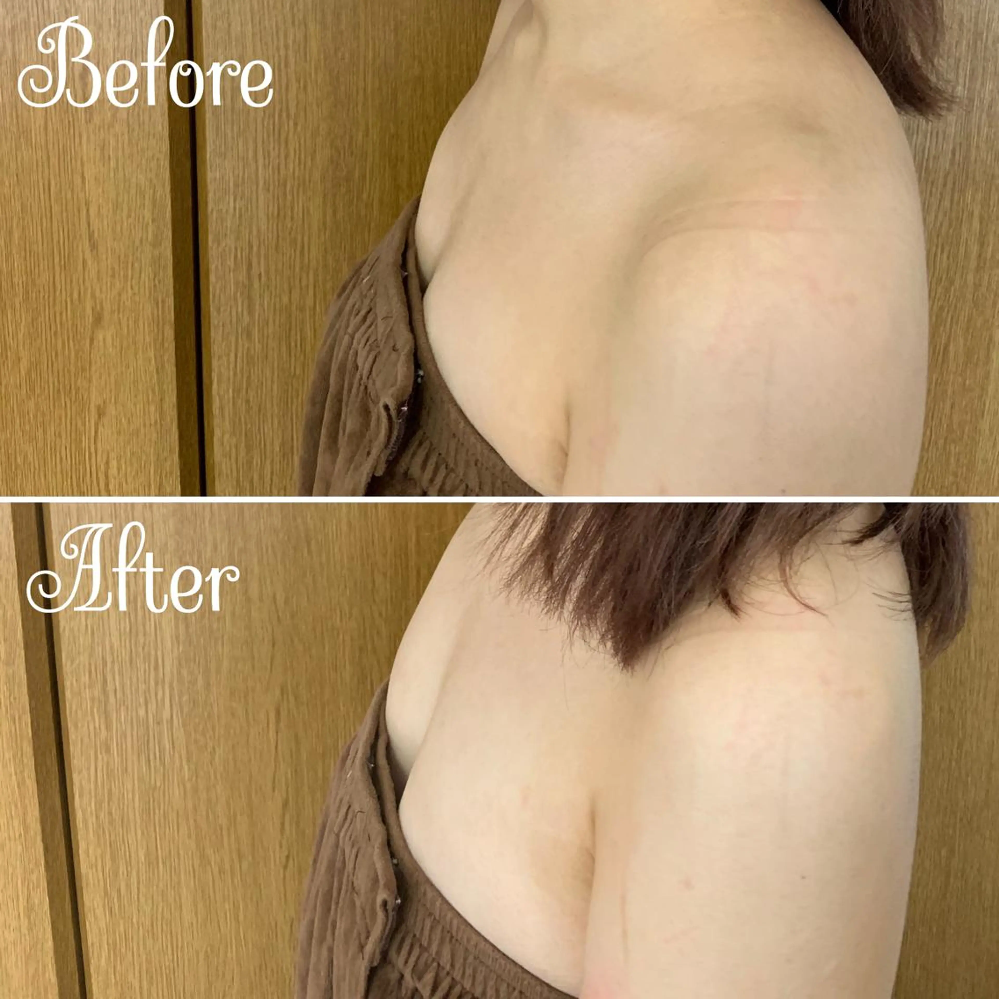 Linomalie エステ/たるみ/脱毛のエステ・リラクイメージ