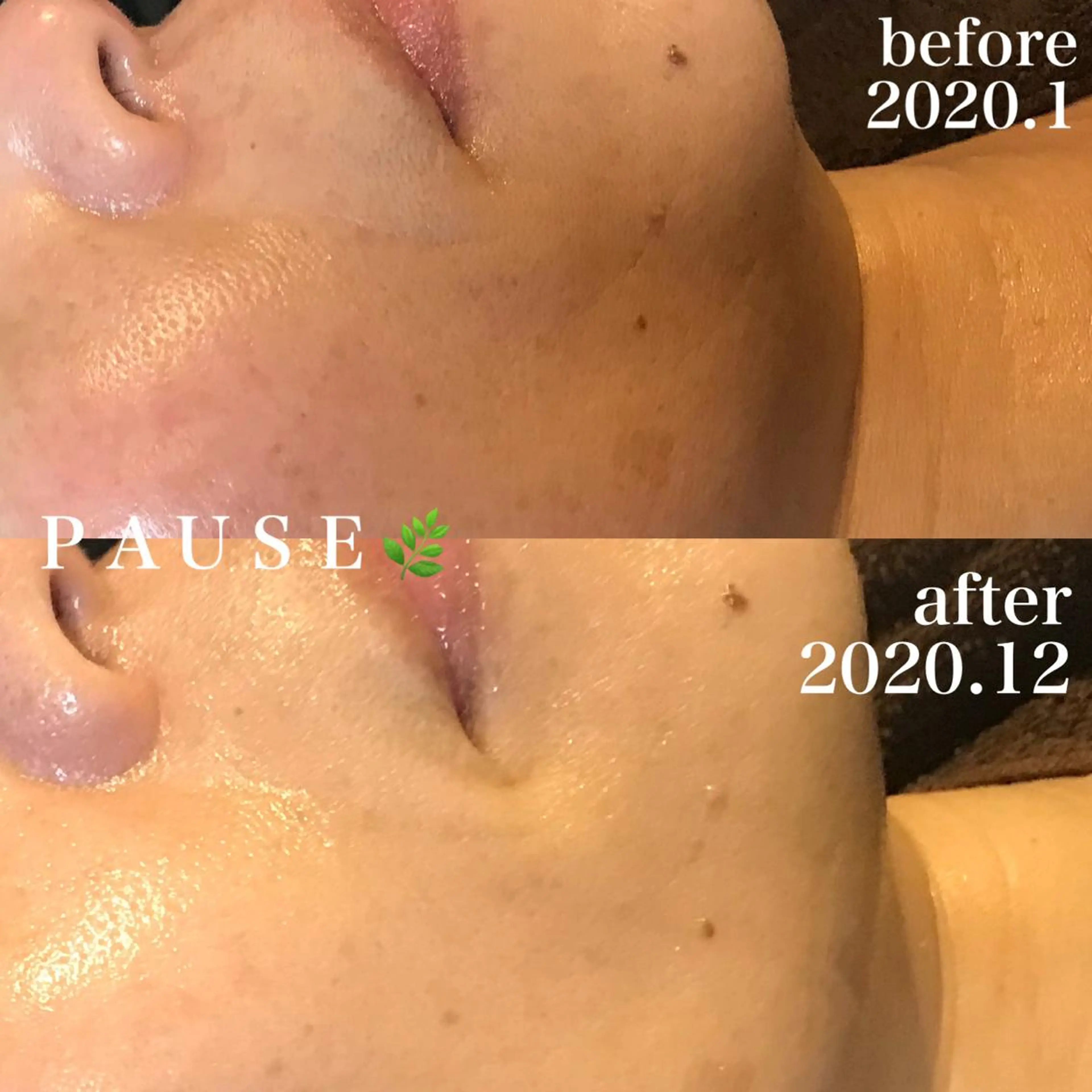 エステ 浜野 恵美のエステ・リラクイメージ