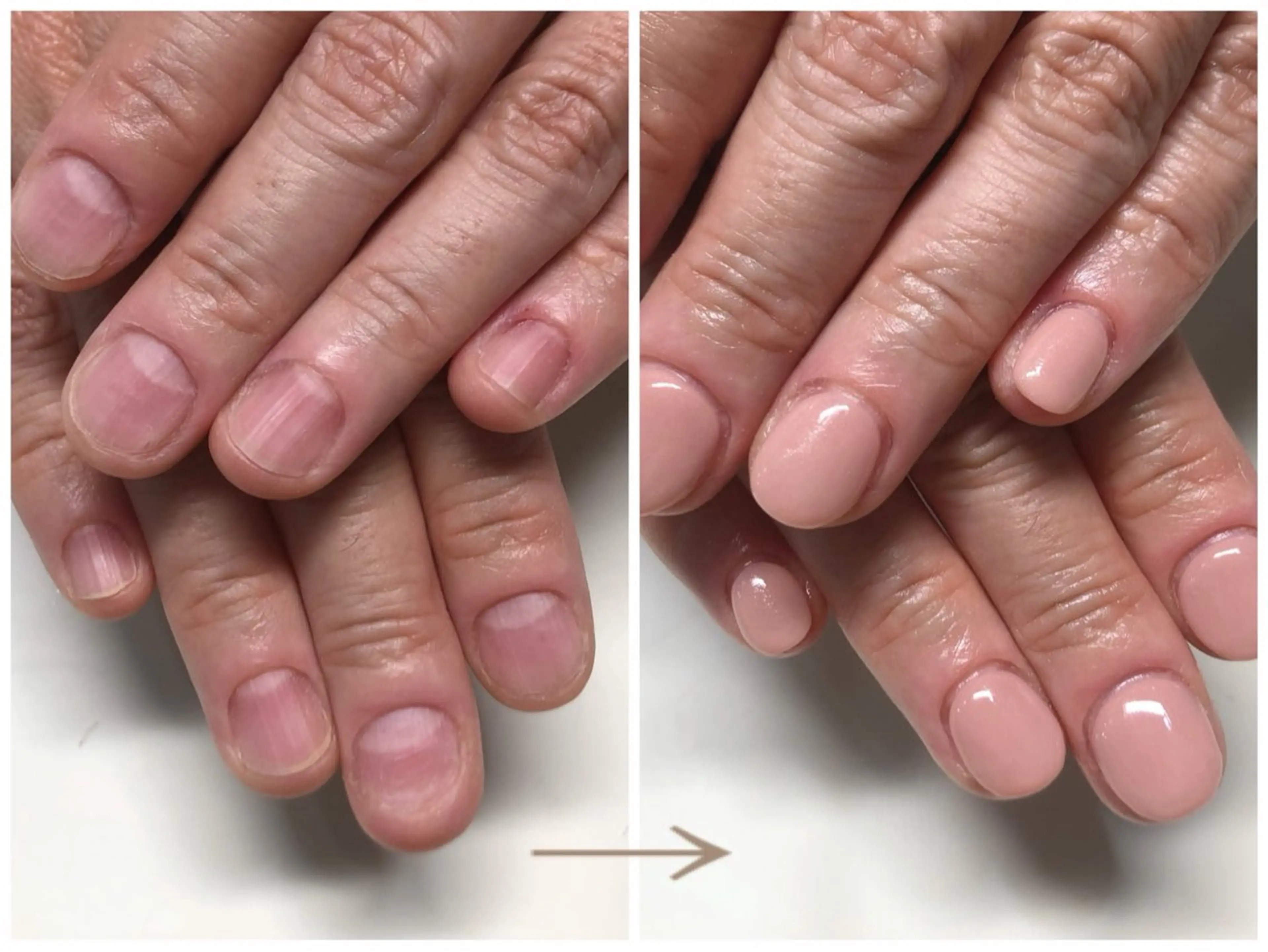 ネイル ワンカラーネイル 深爪矯正・自爪育成 ヴェールリムのネイルデザイン