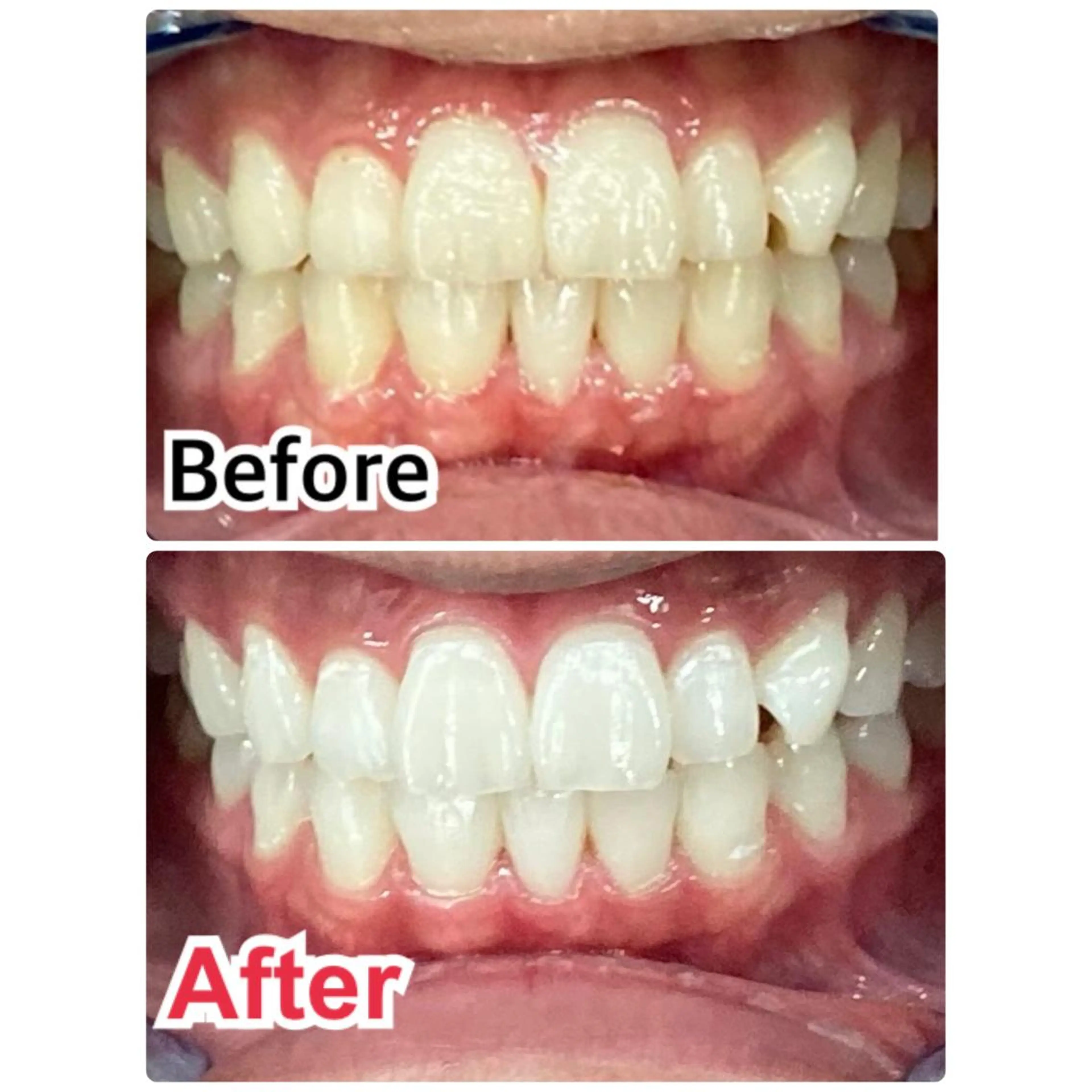 ミディアム キッズ ネイル マツエク・マツパ アイブロウ ホワイト 【歯科提携】柏ホワイ トニングスタイルのその他イメージ