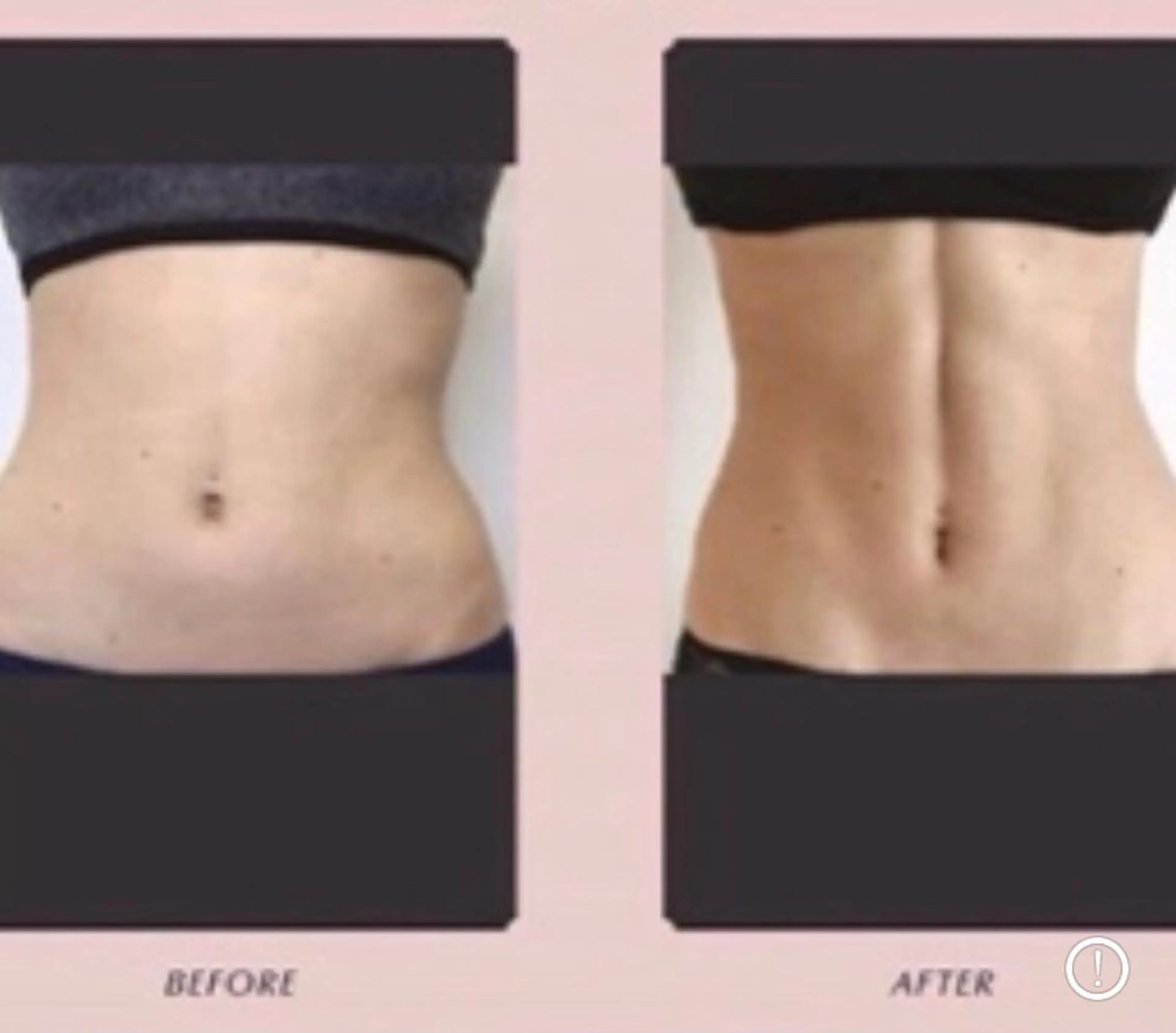 アクシア ビューティー サロン所属・究極のアンチエイ ジングサロンのエステ・リラクイメージ