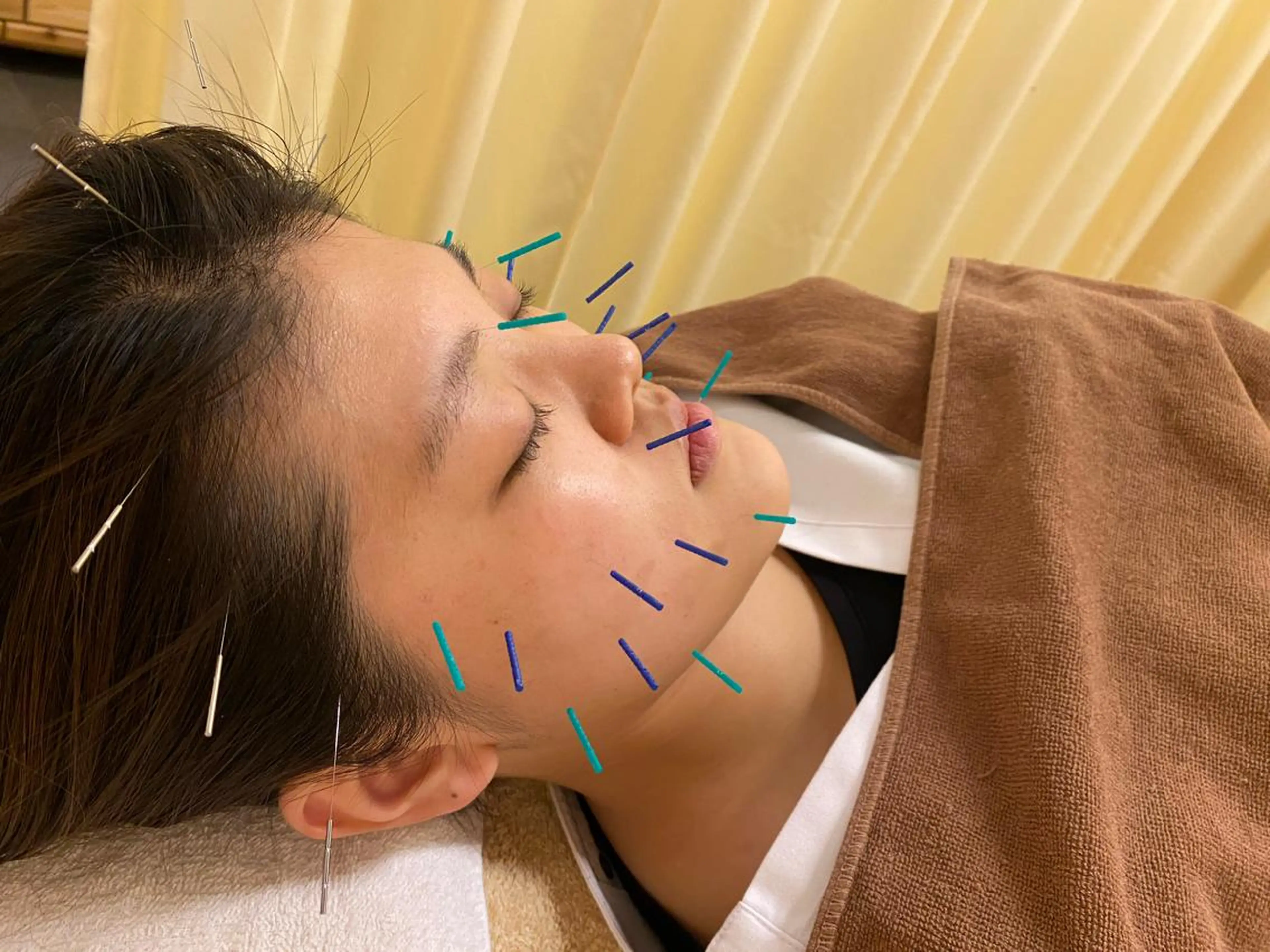 BBB3(ビースリー)所属・鍼灸サロン BBB3のその他イメージ