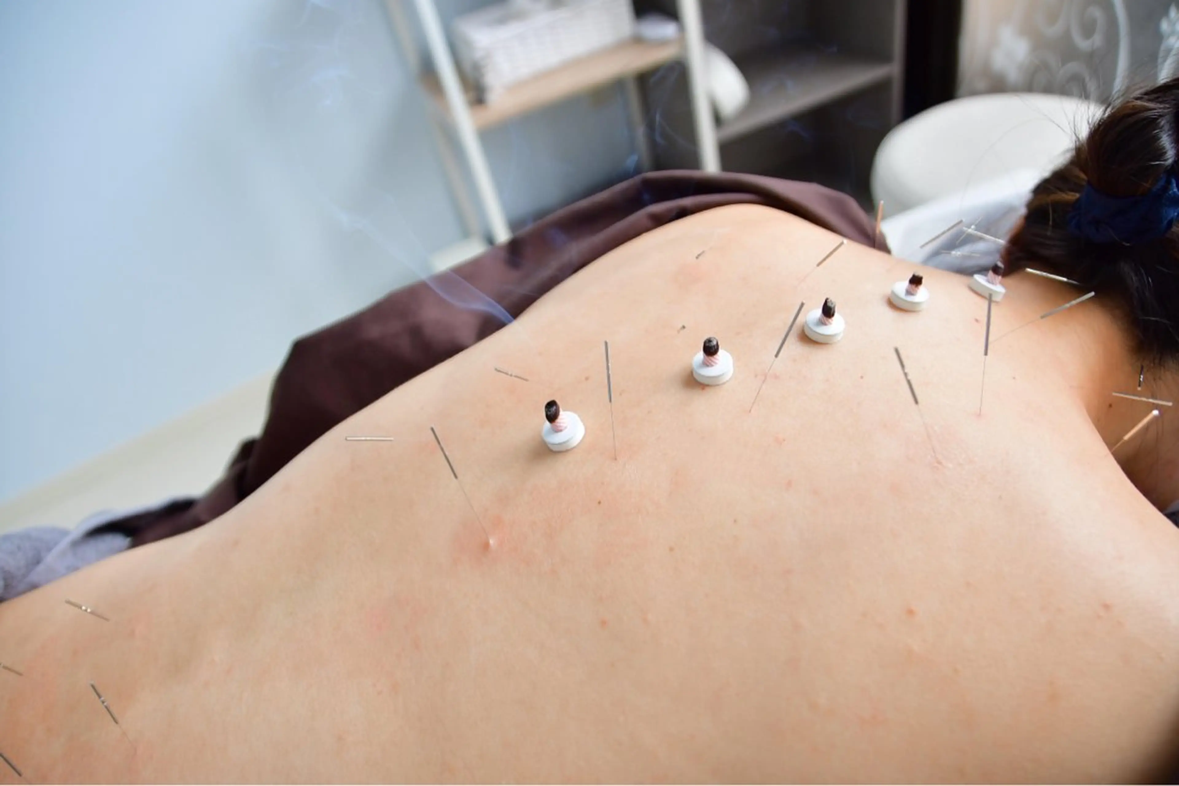 その他 ここの はりきゅう治療院のエステ・リラクイメージ