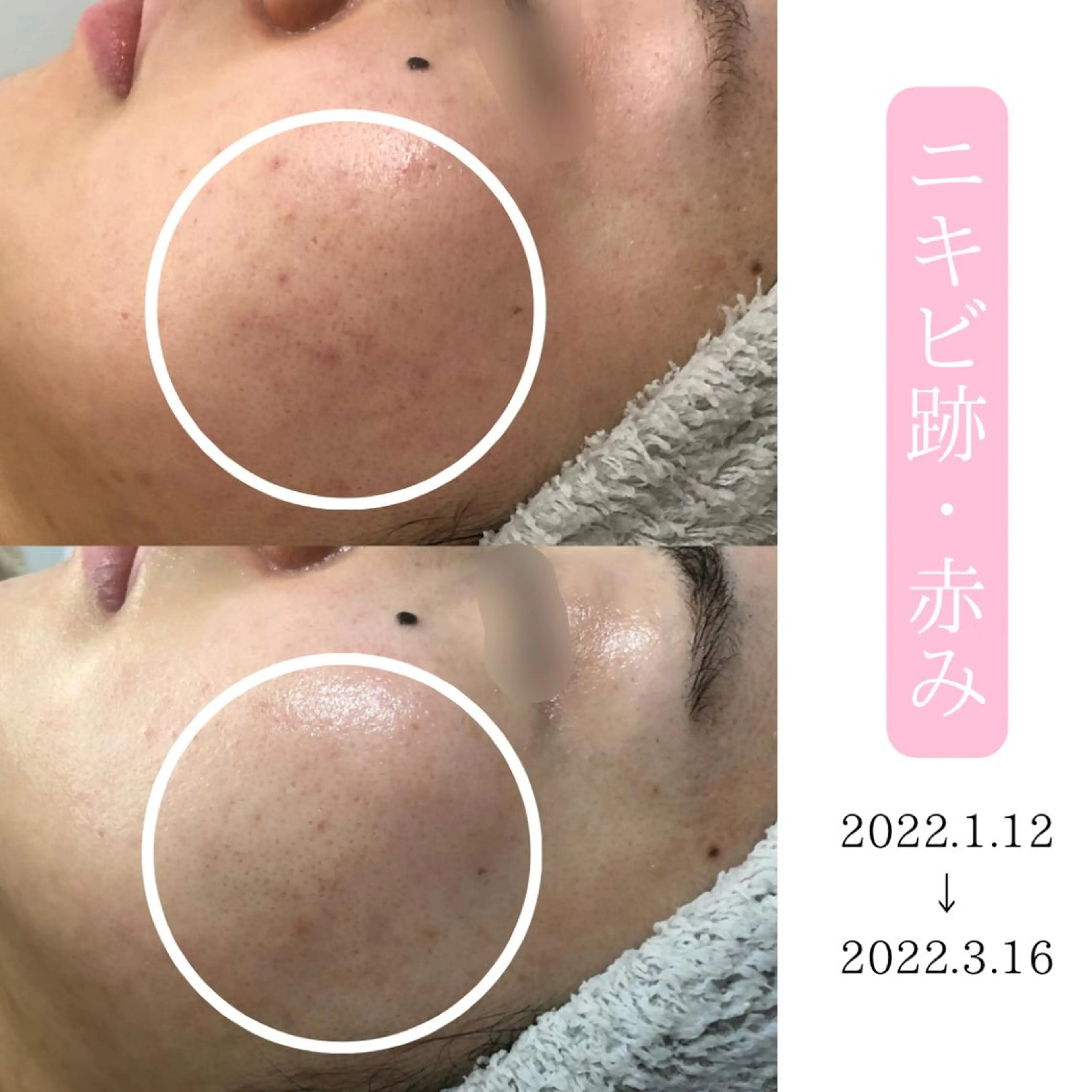 肌質改善サロン BestBelleのエステ・リラクイメージ