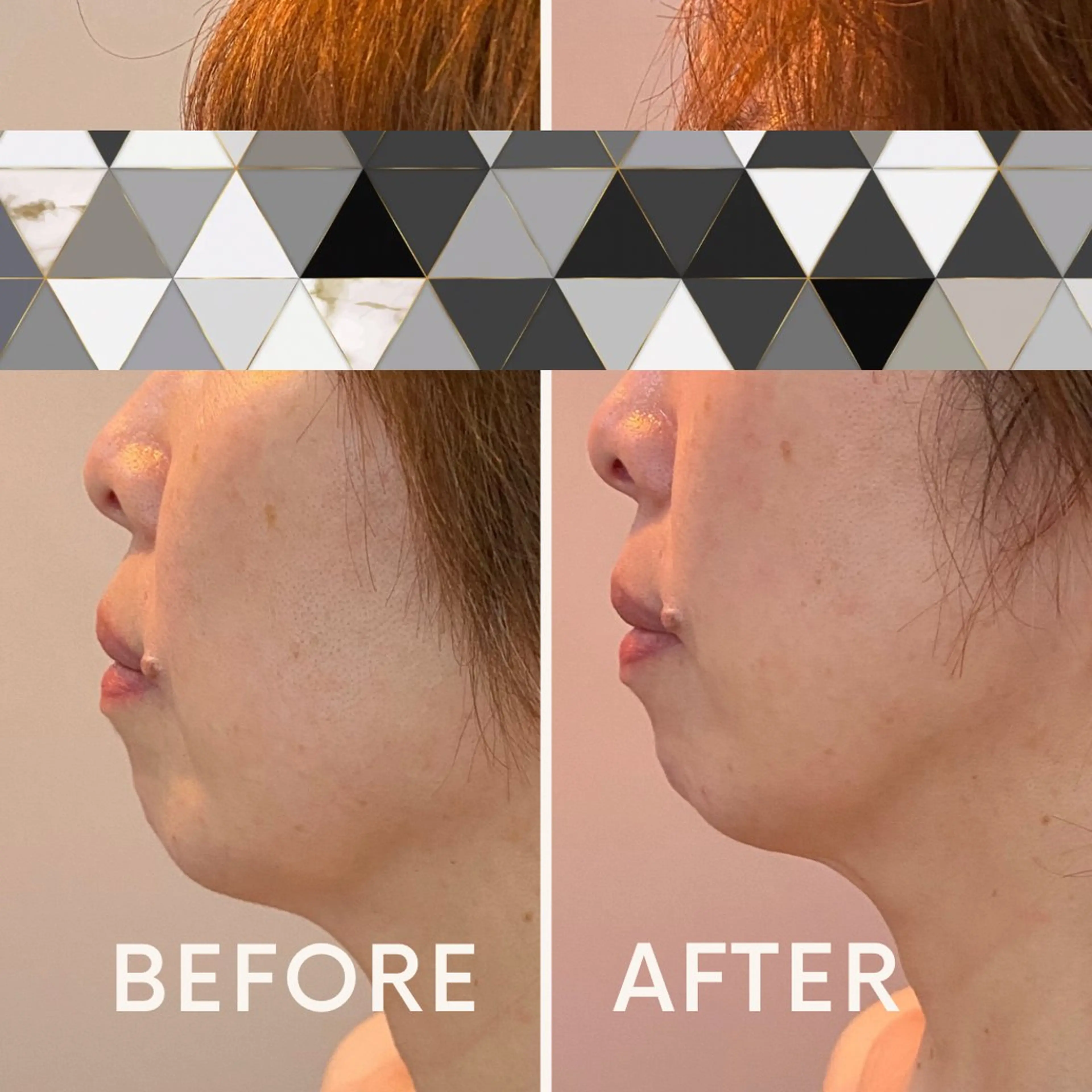 エステ 美容と育毛のサロン Link　松浦のマツエク・マツパデザイン