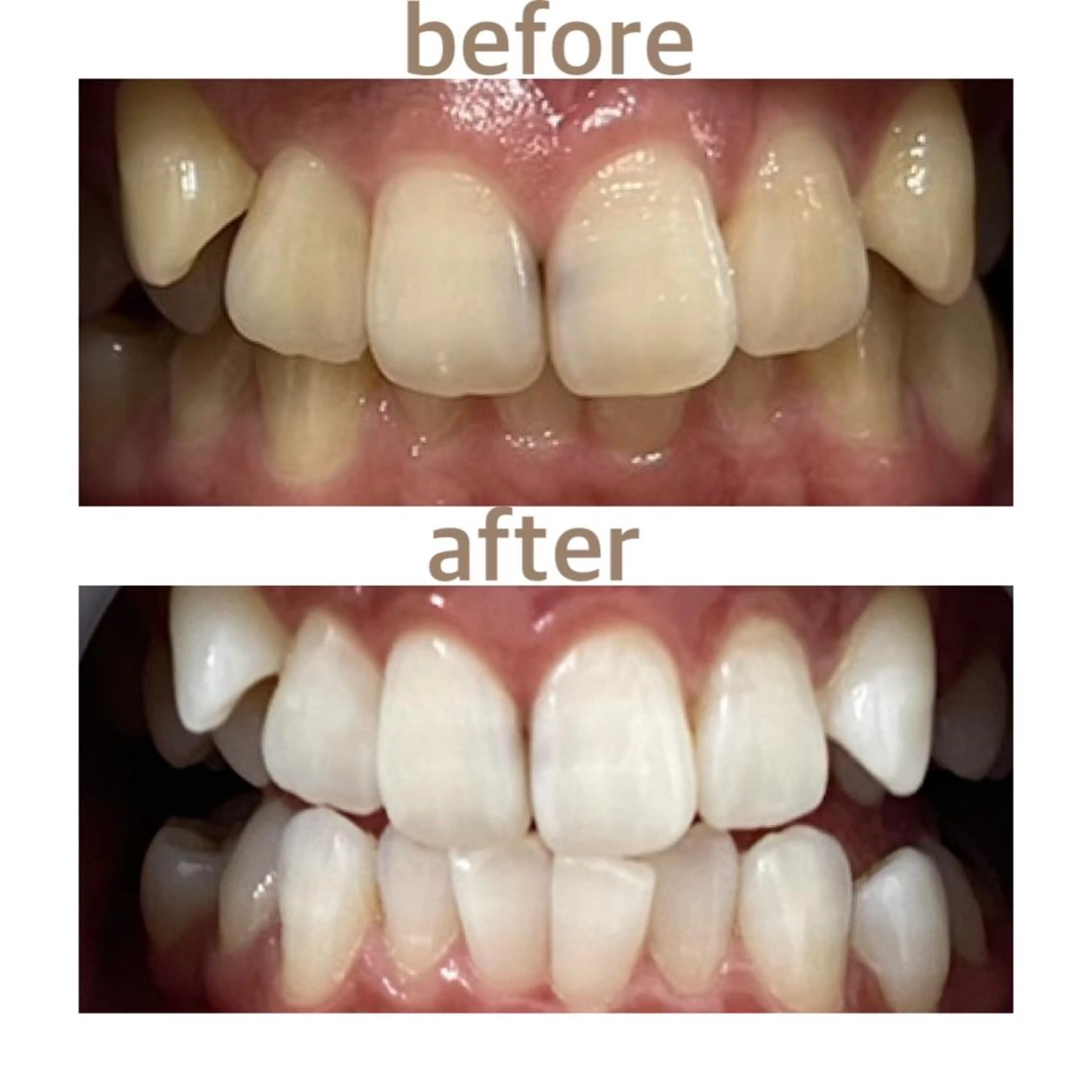 メンズ その他 ホワイトニング ショップ本八幡店のエステ・リラクイメージ