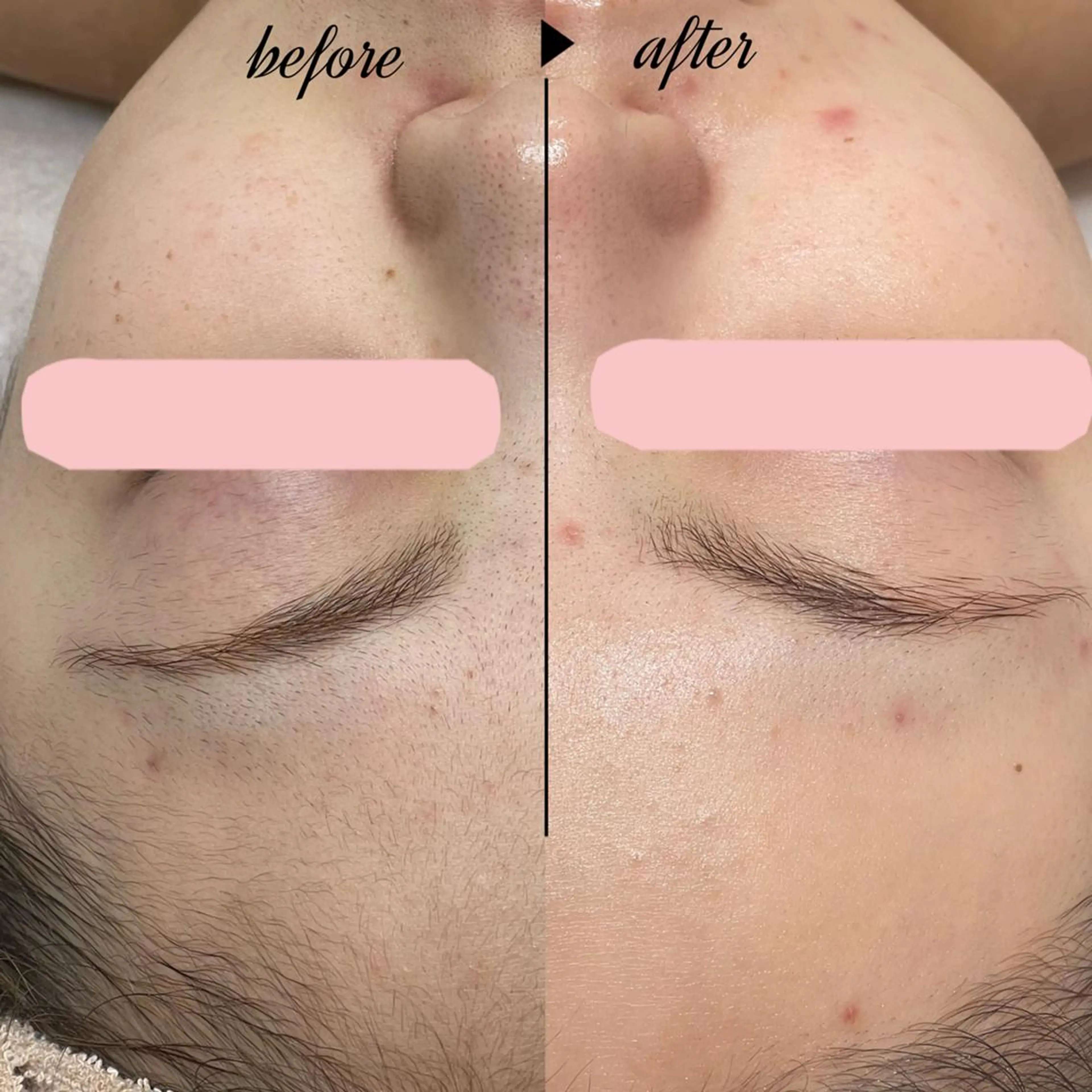 🎀美肌サロン レイビス川崎店🎀のエステ・リラクイメージ