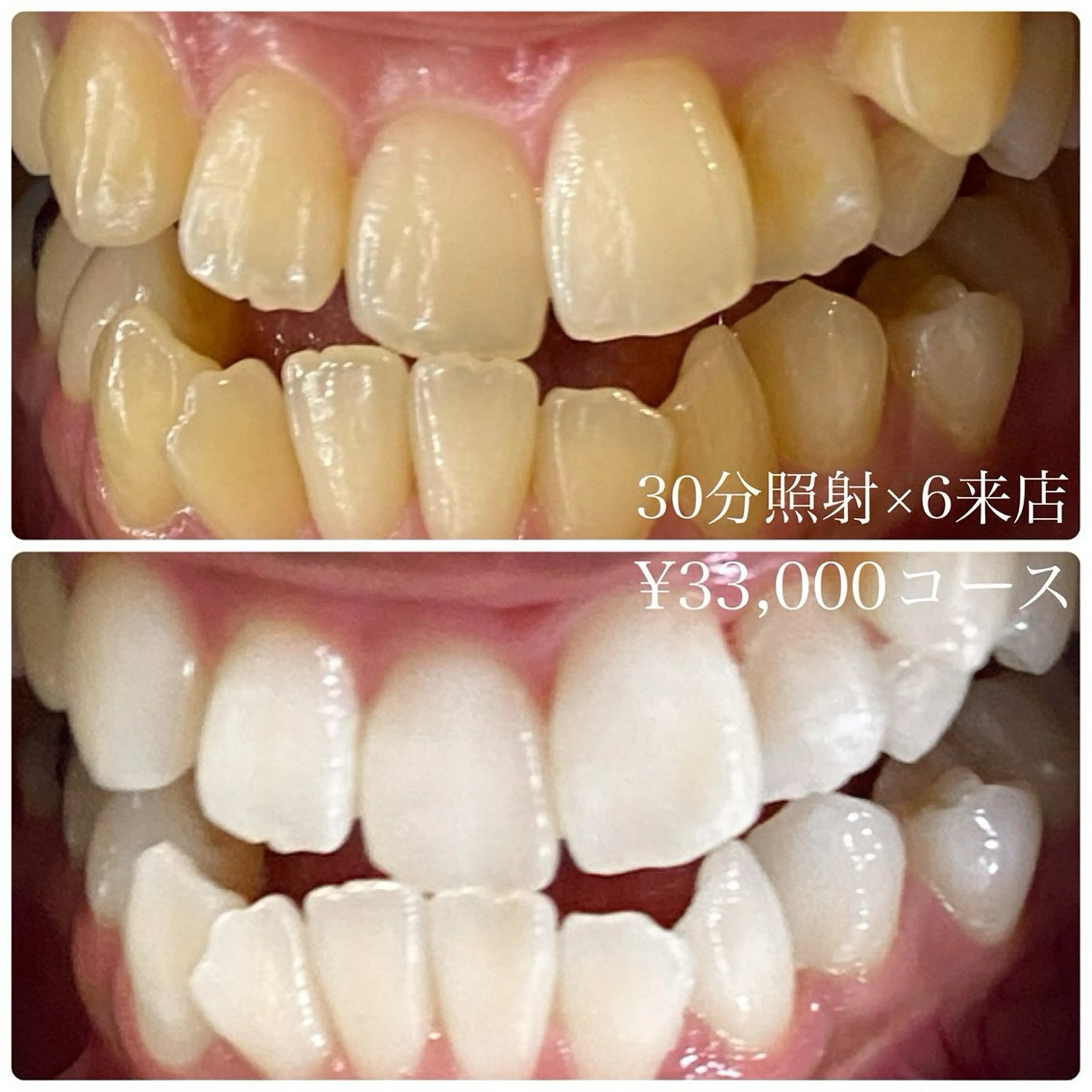 その他 PLATINUM Beauty 横浜店所属・ホワイトニングルーム 横浜店のその他イメージ