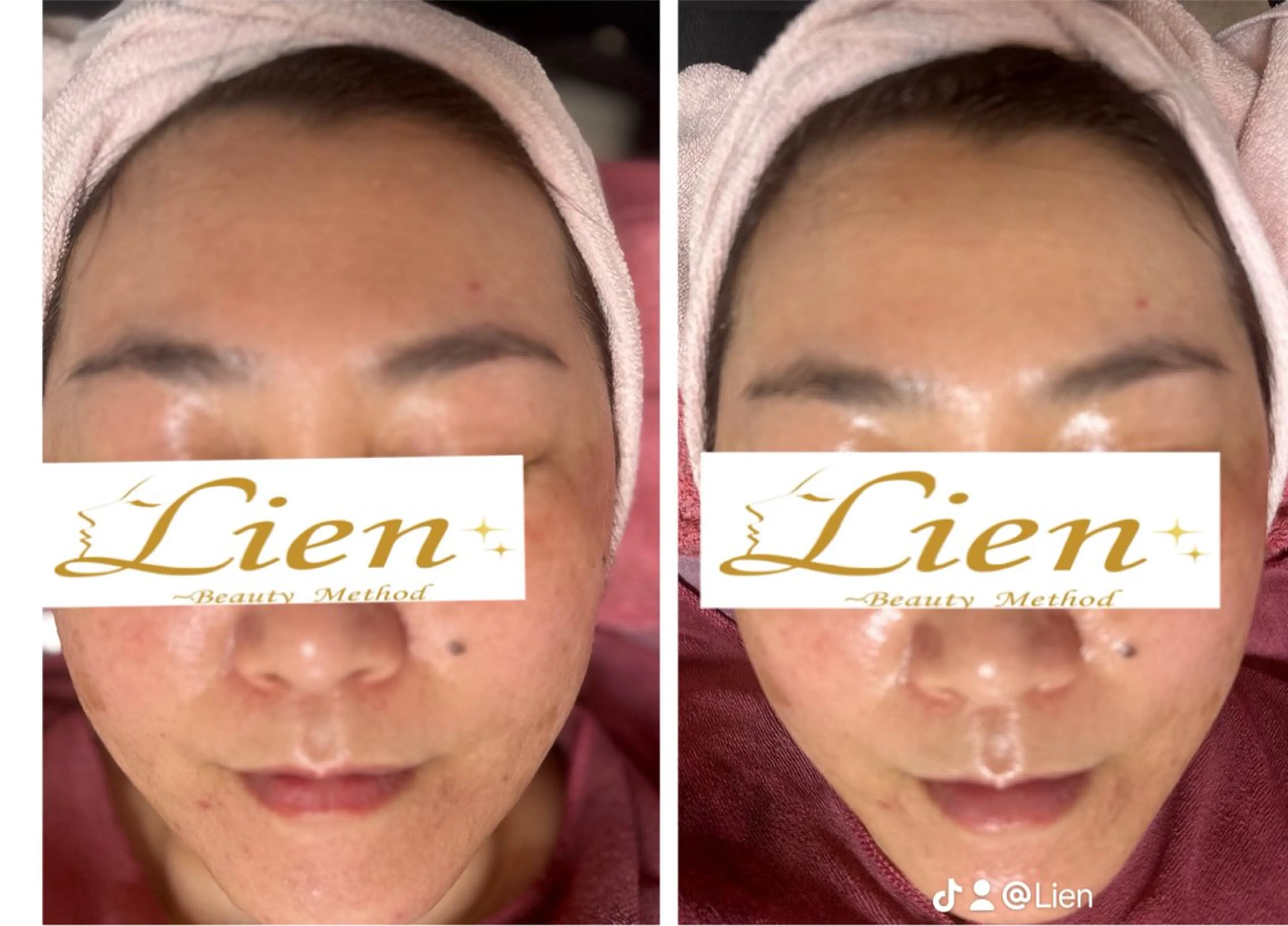 エステ Lien オーナー　山口智嘉のエステ・リラクイメージ