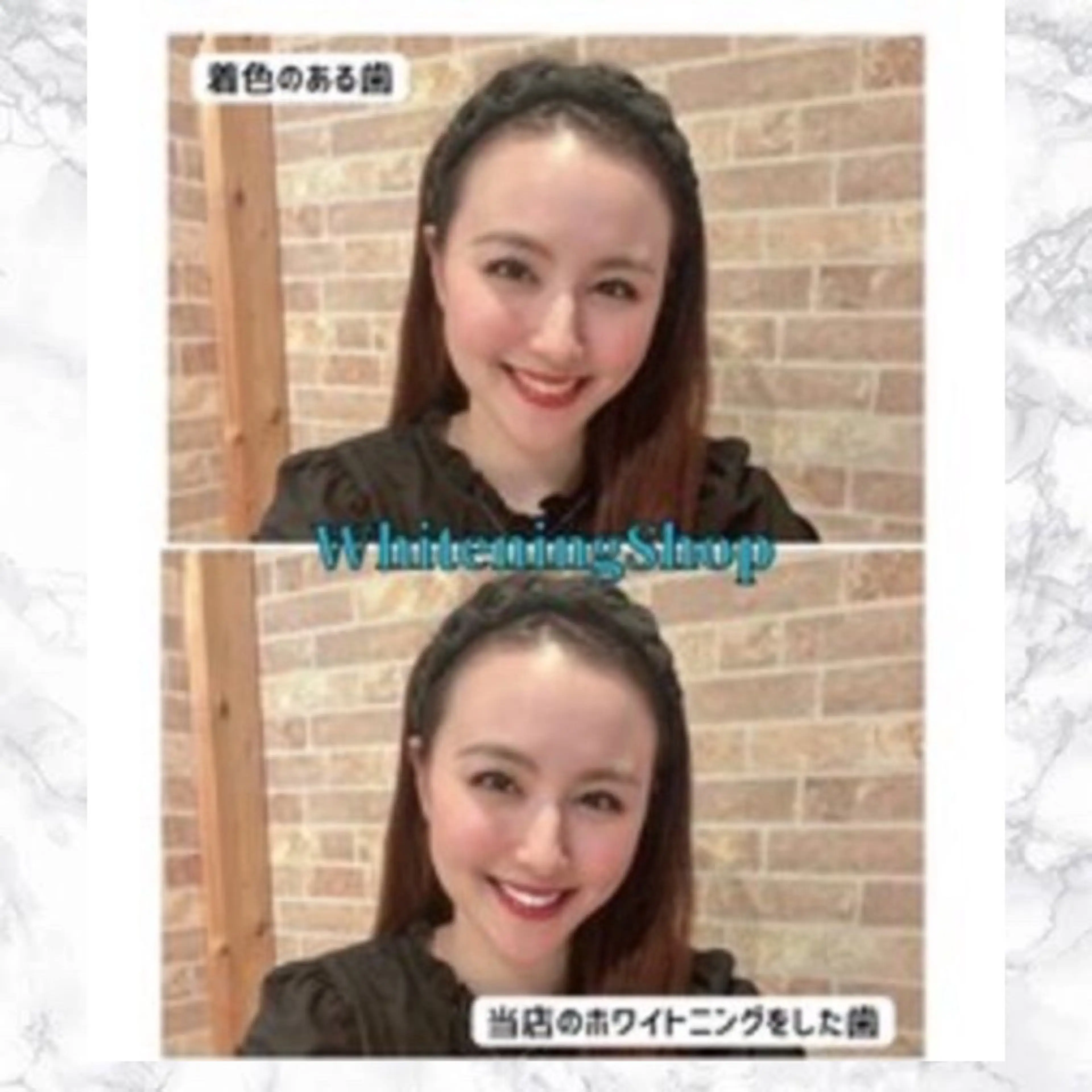 その他 ホワイトニング ショップ津店のその他イメージ