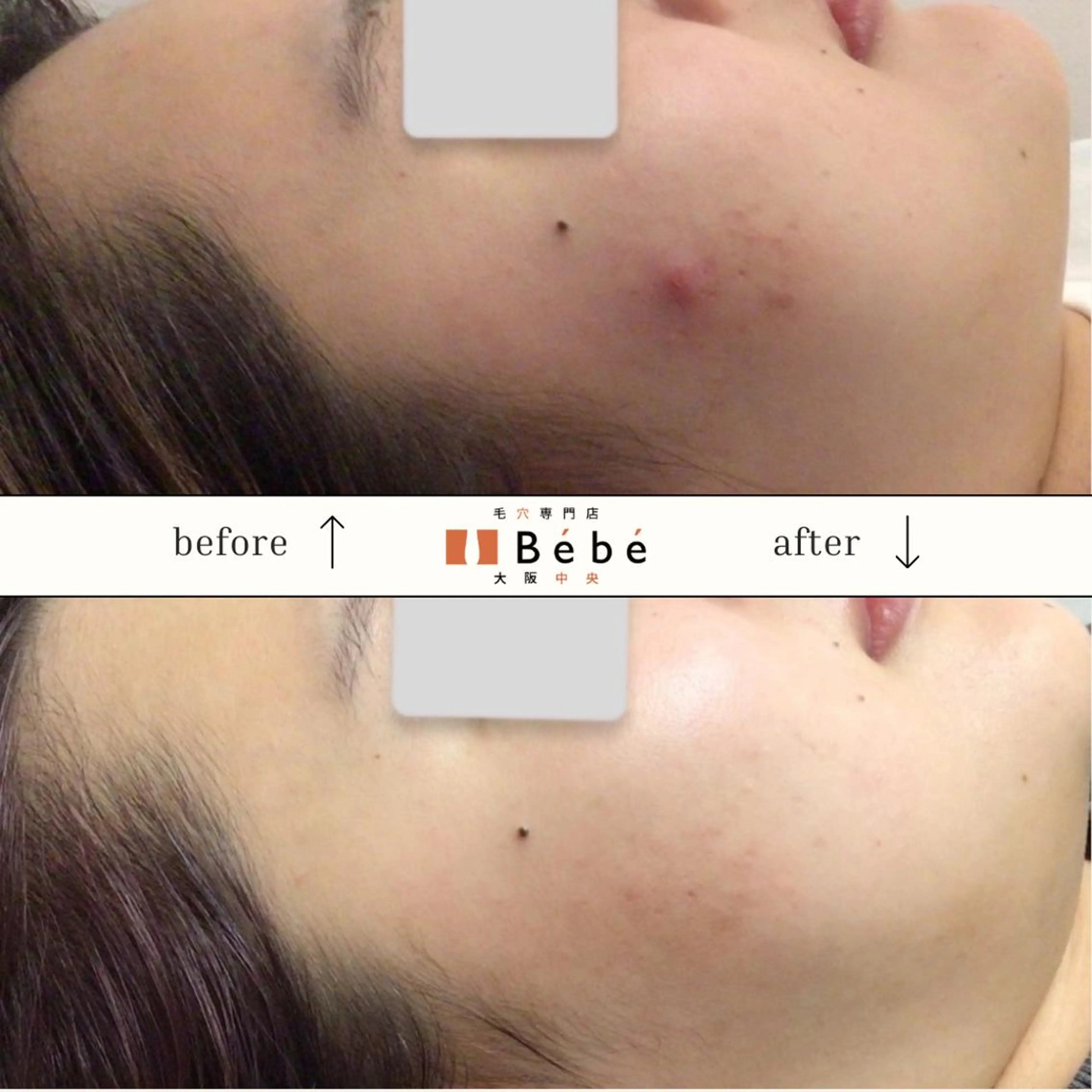 毛穴専門店Bébé 大阪中央店のエステ・リラクイメージ