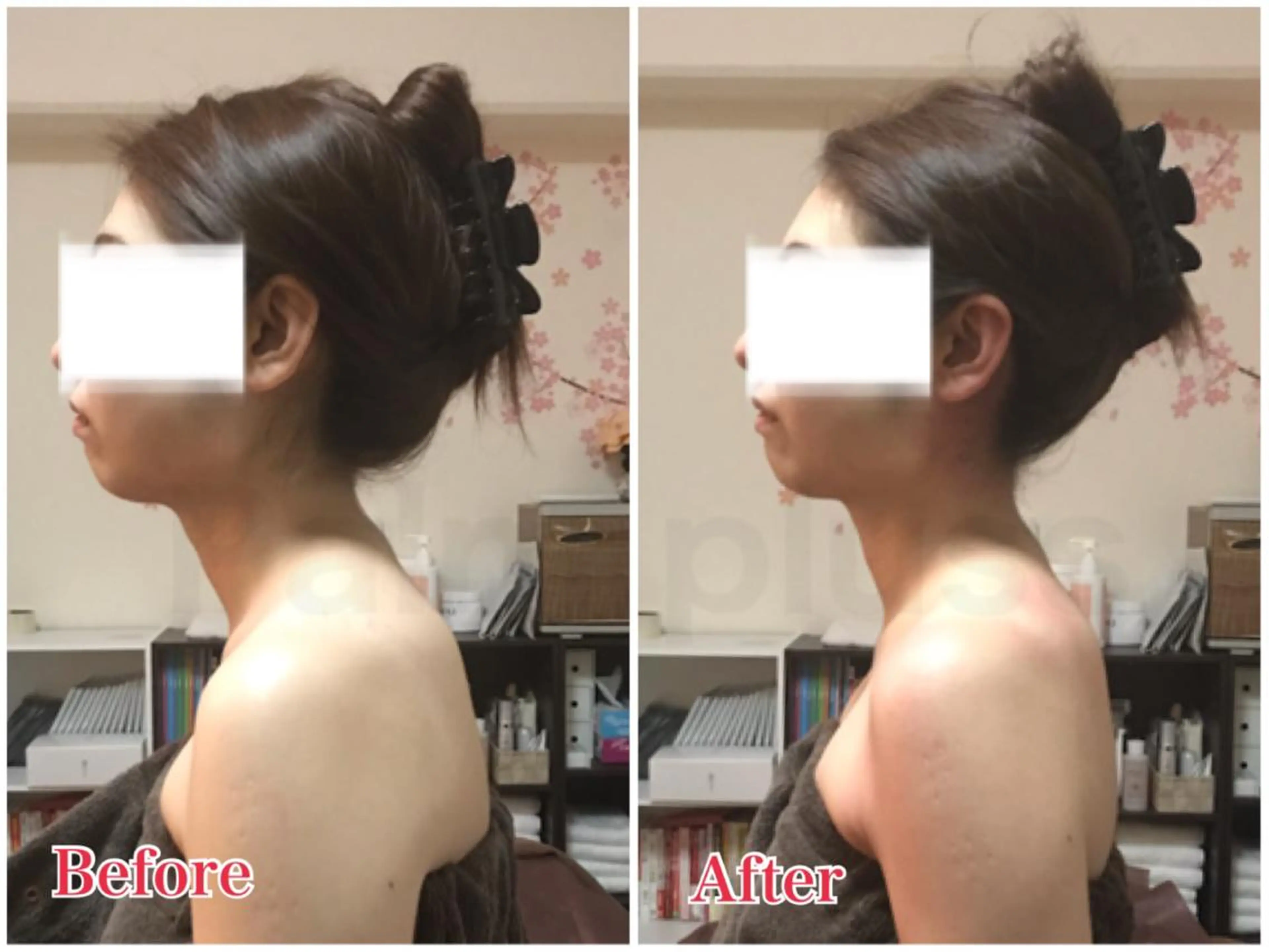 首肩こり専門サロン Kalnicco/カルニッコ所属・Kalnicco (カルニッコ)のエステ・リラクイメージ