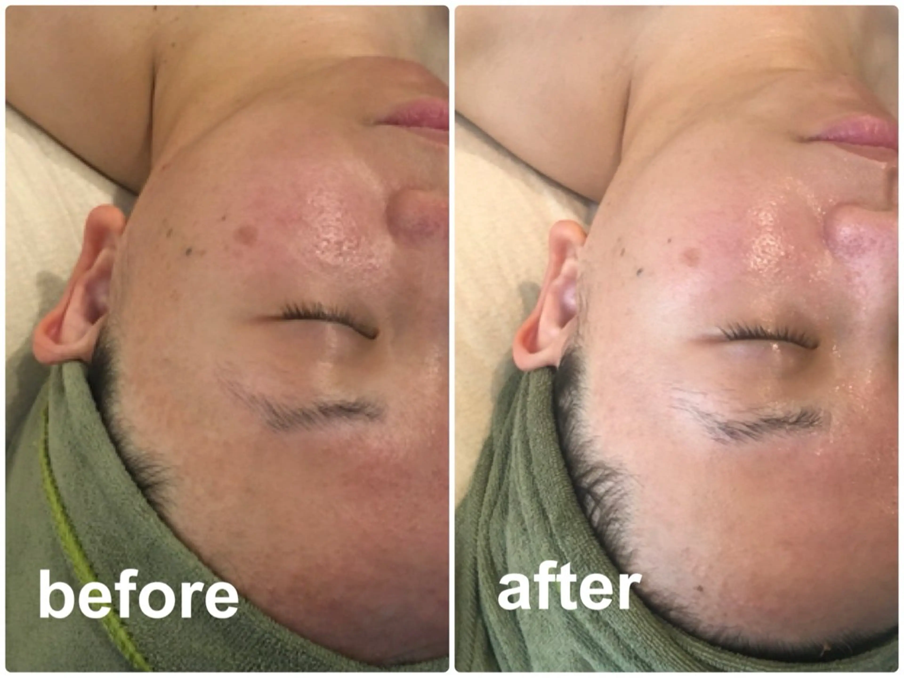 ブライダルエステ専門 入谷友莉のエステ・リラクイメージ