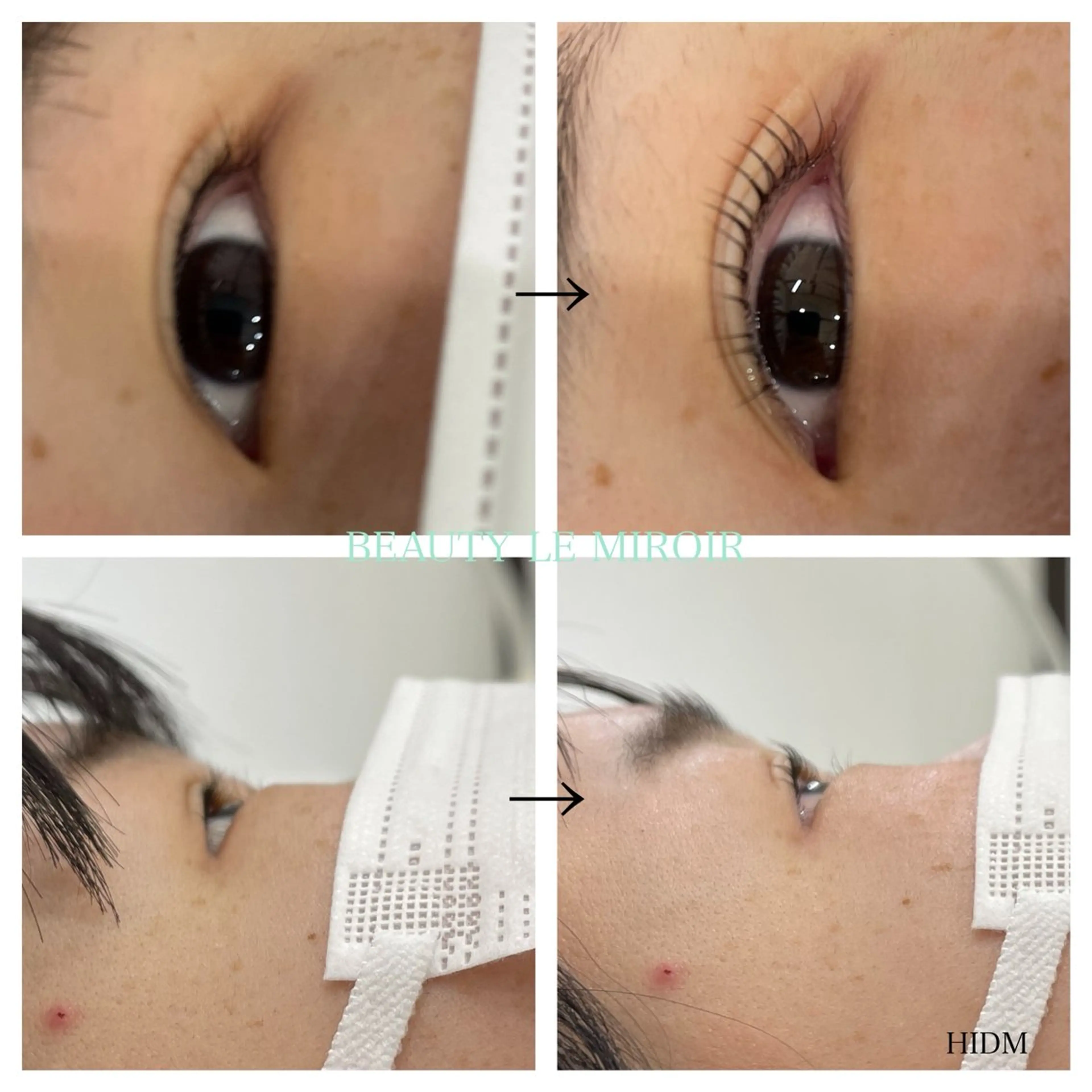 マツエク・マツパ ビューティー ミロワールのエステ・リラクイメージ