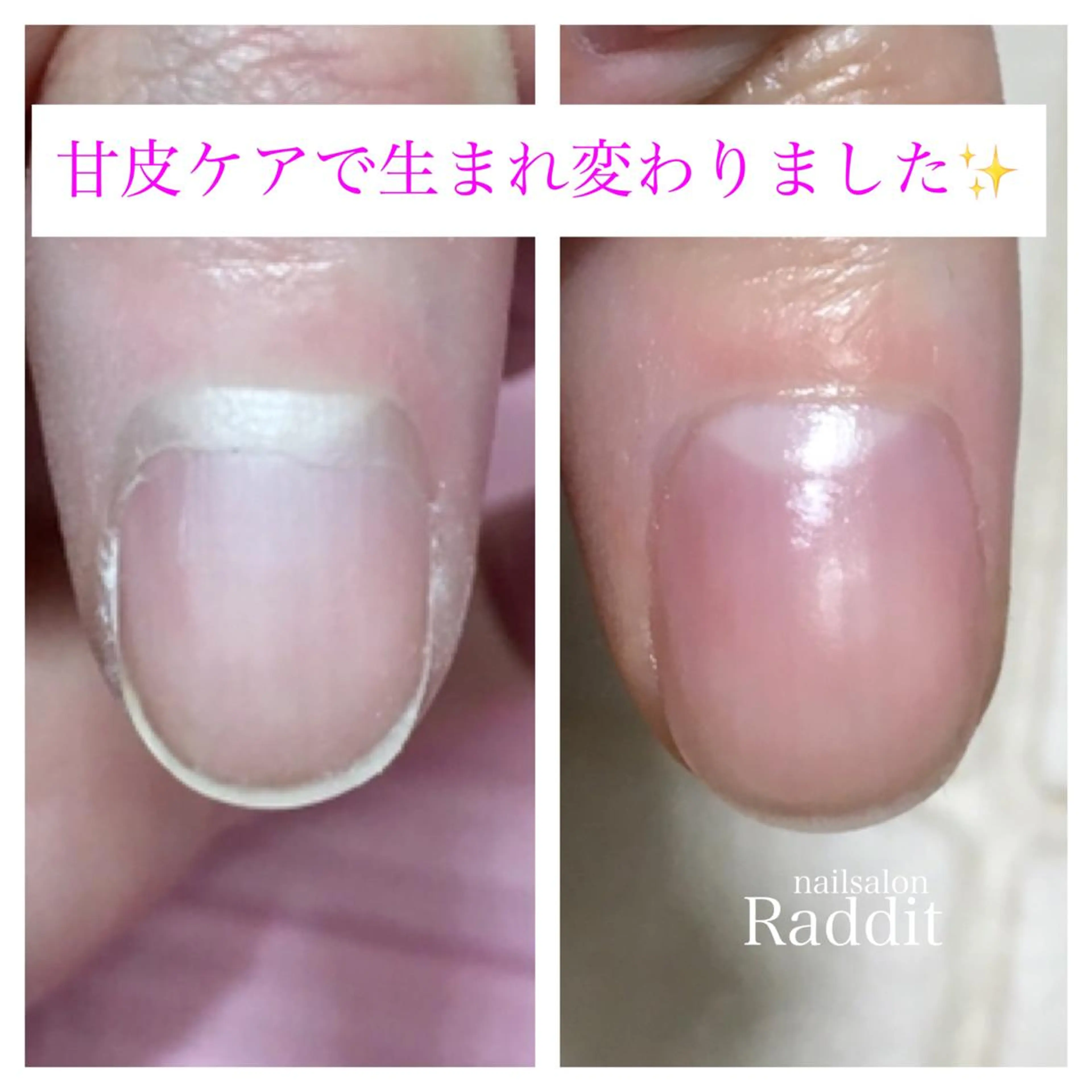 ネイル nailsalon Radditのネイルデザイン