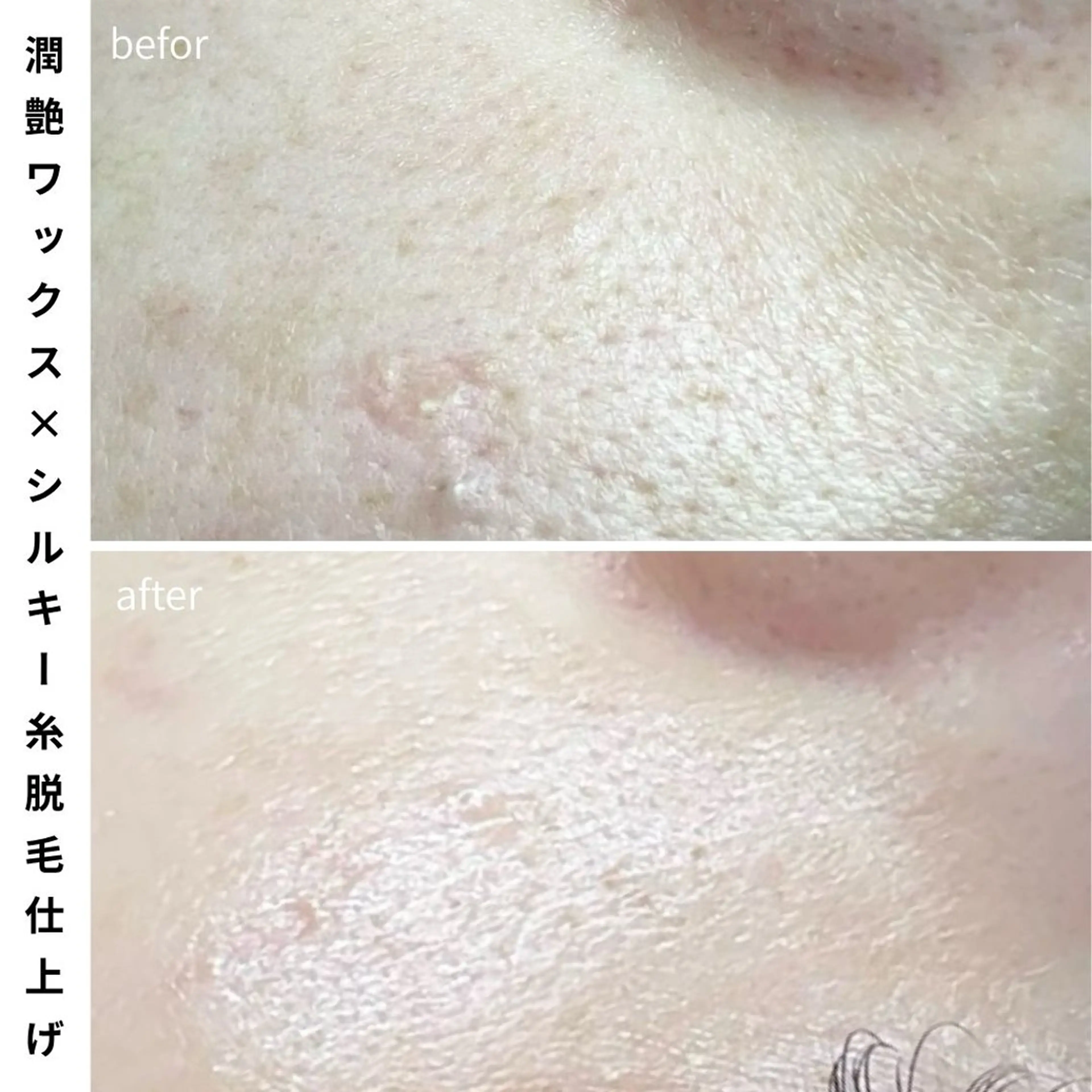 脱毛 Muqu.所属・Muqu. 毛穴サロンのエステ・リラクイメージ