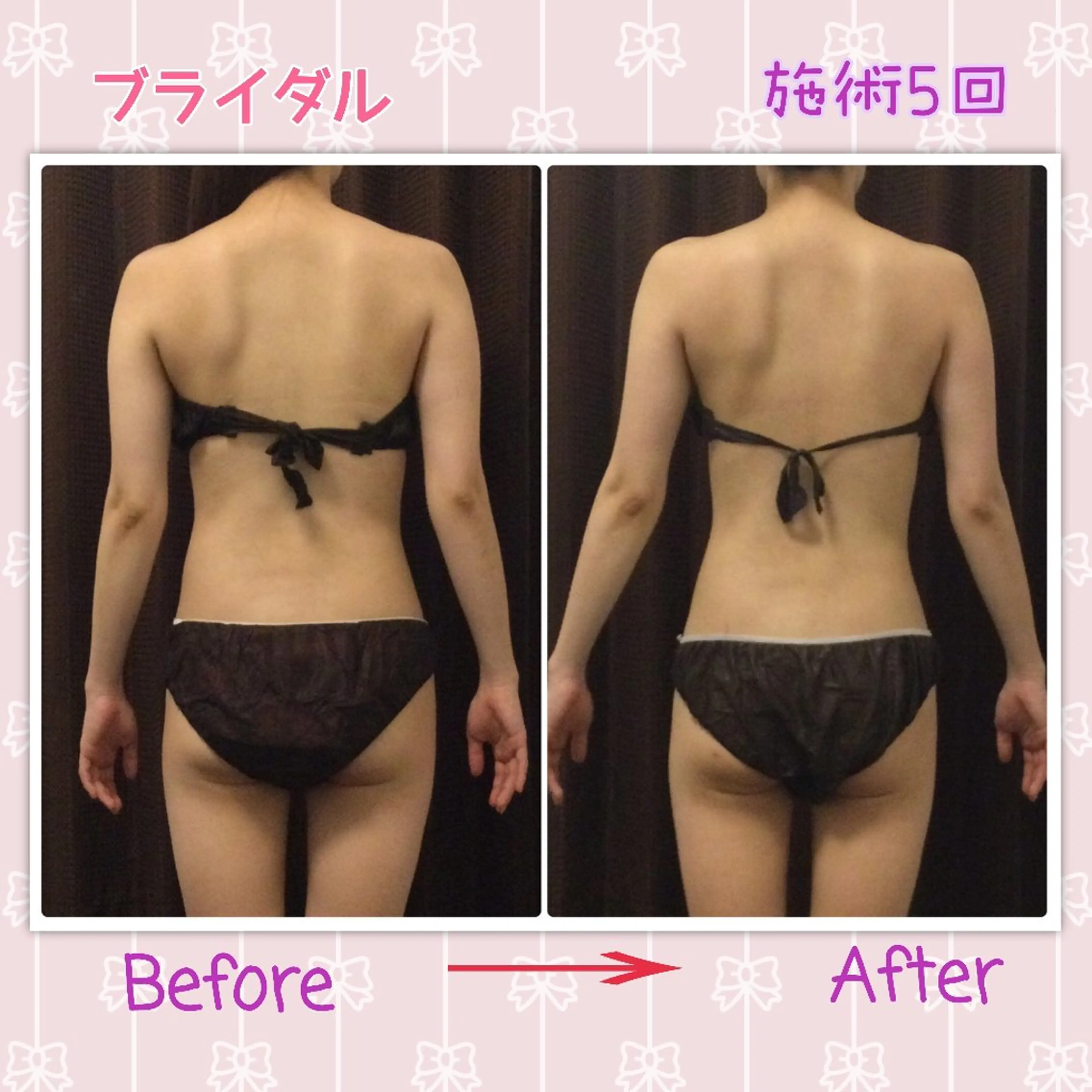 美やせ専門店 B'PRODUCE 豊田店【ビープロデュース】所属・ビープロデュース 山下幸恵のエステ・リラクイメージ