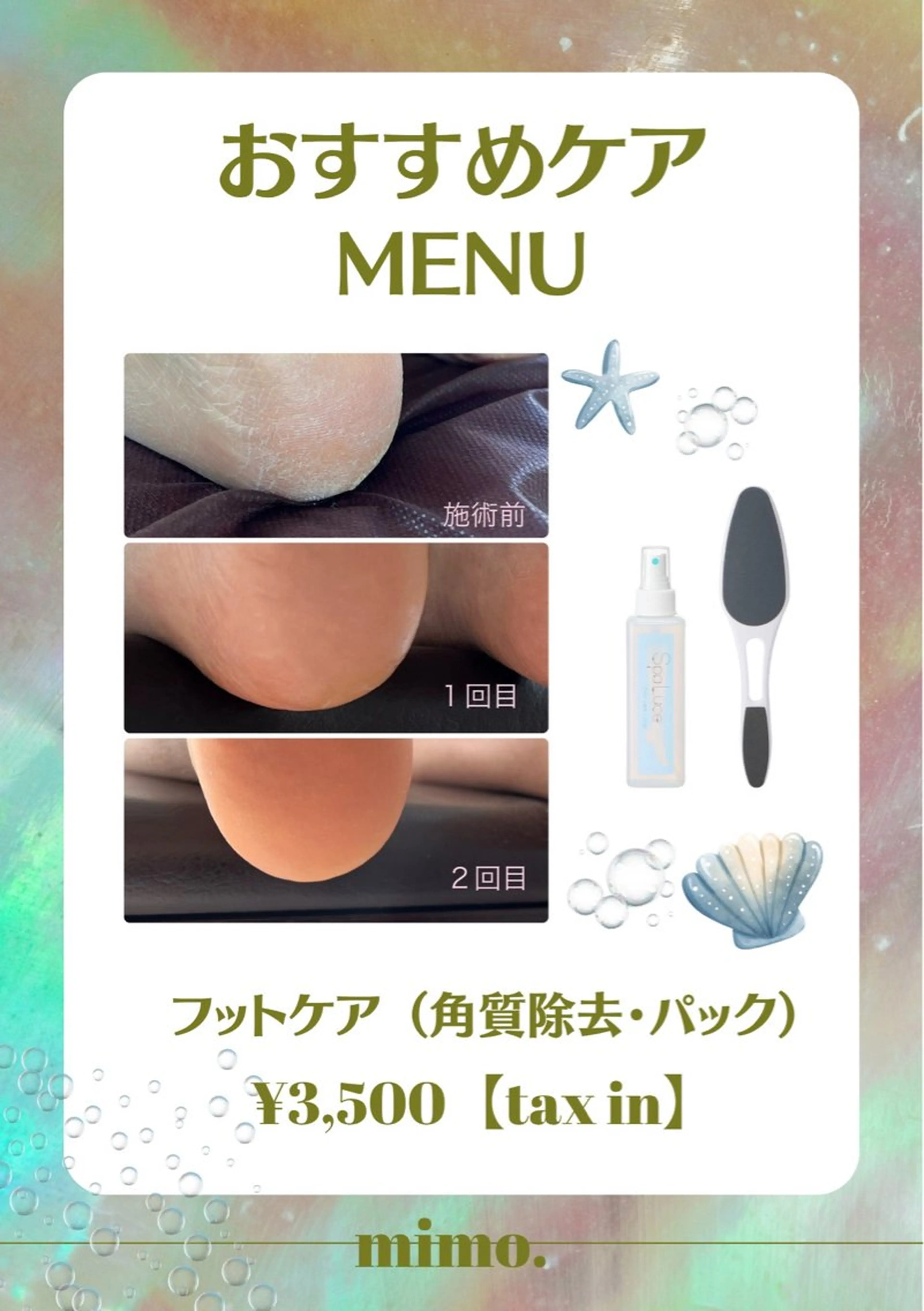 フットケアの写真