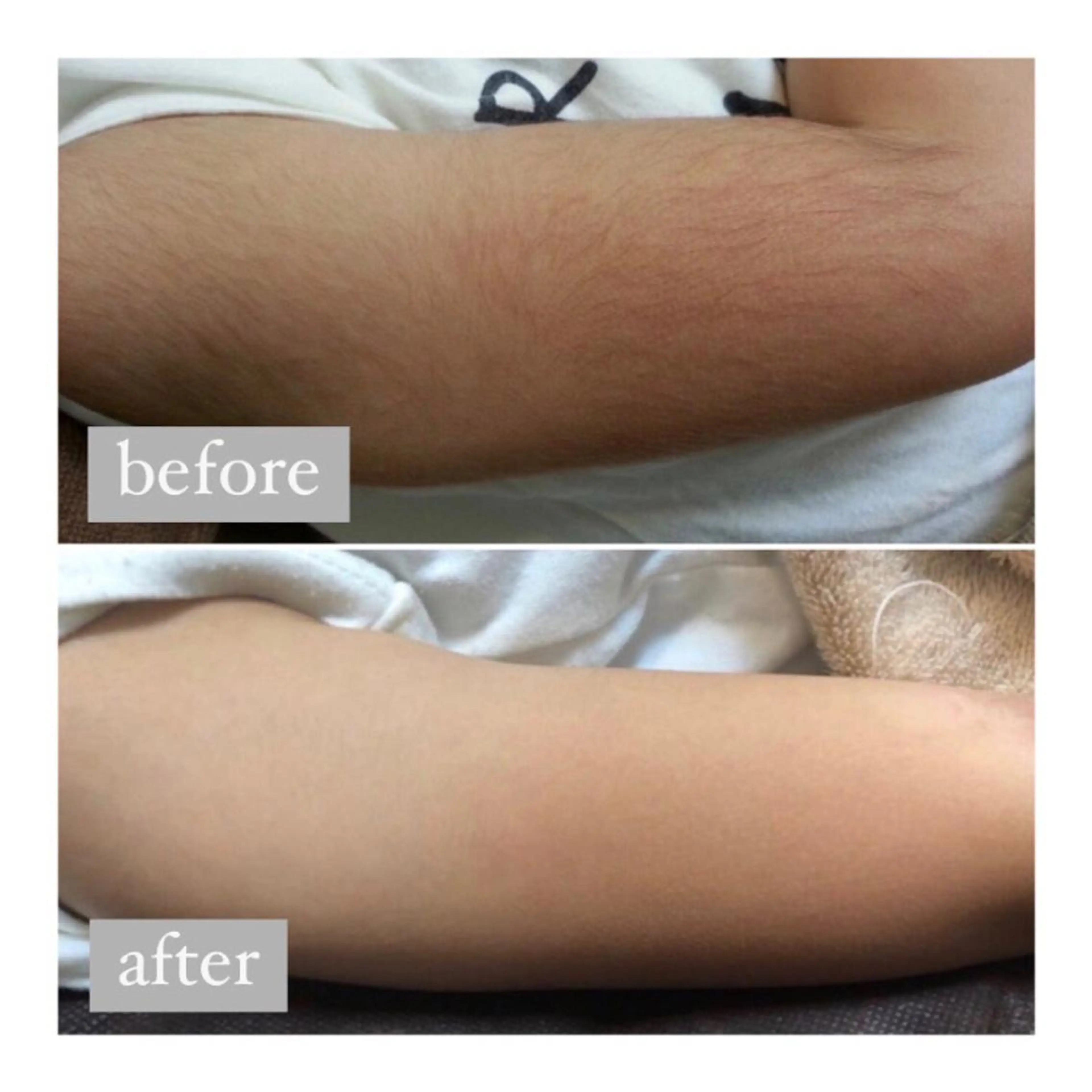 エステ 美肌脱毛専門サロン Dione栄店のエステ・リラクイメージ