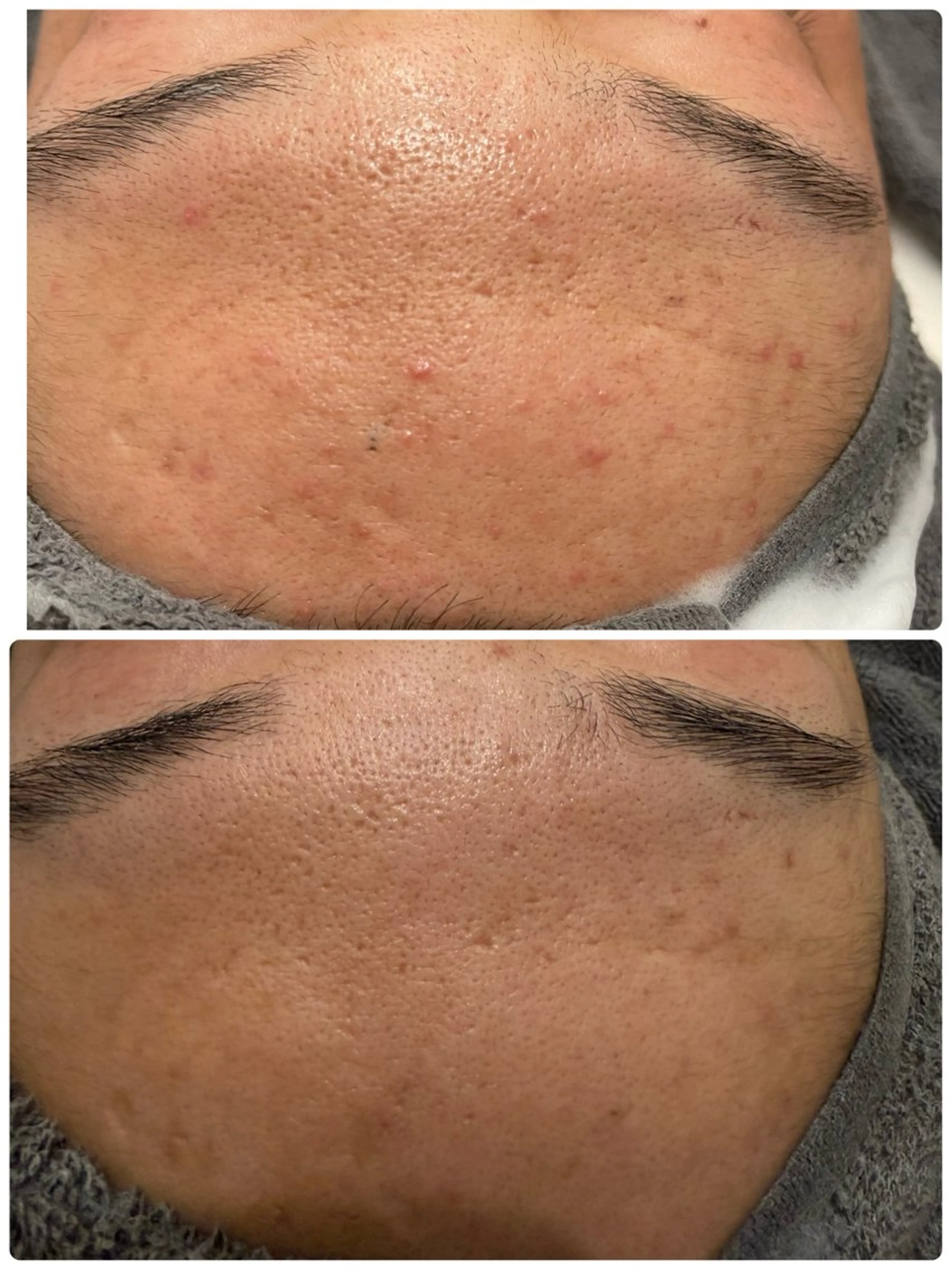 エステ NHerb【エヌハーブ】所属・横田 汐里のネイルデザイン