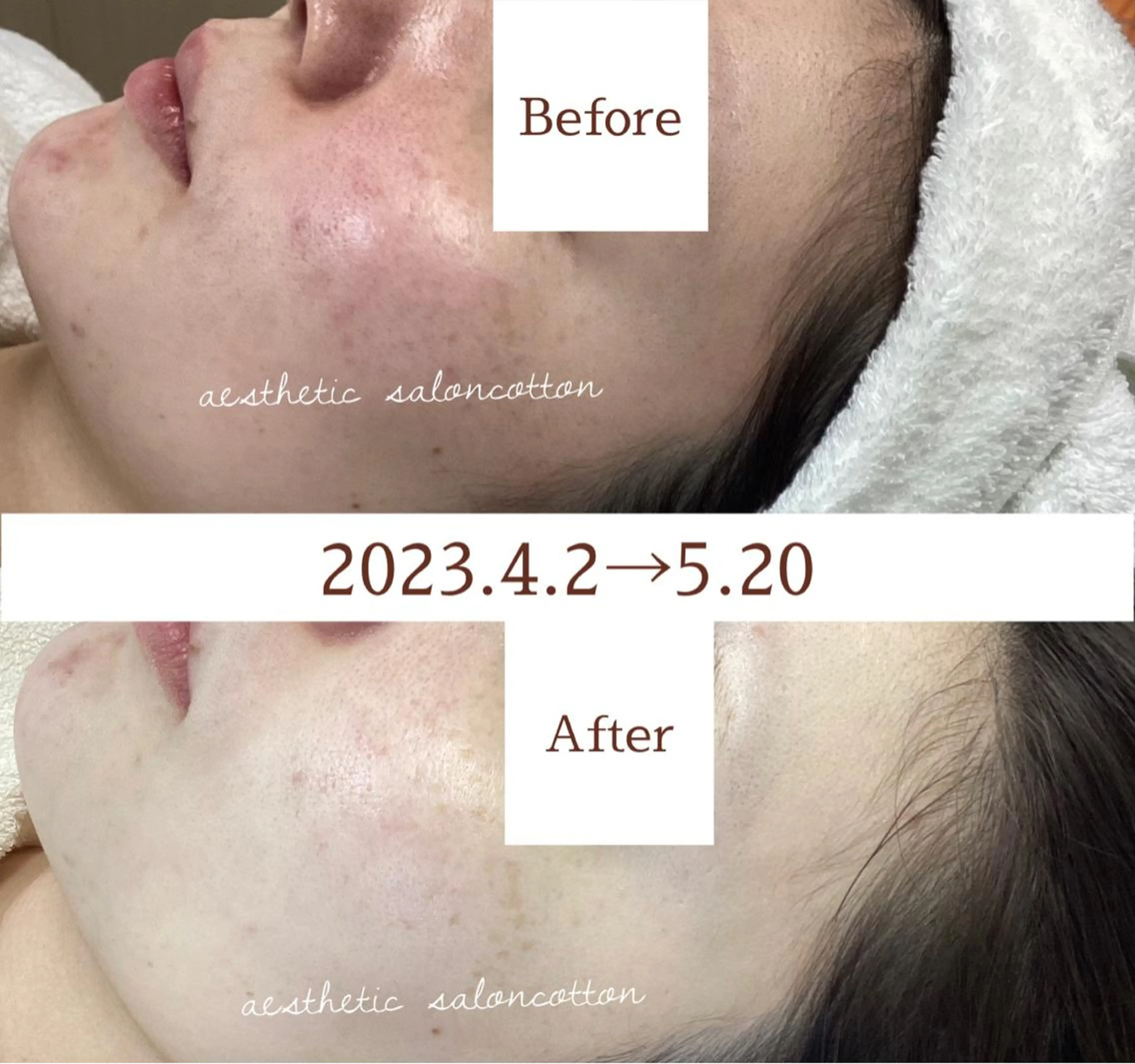 エステ 都度払い 肌質改善専門サロンのエステ・リラクイメージ