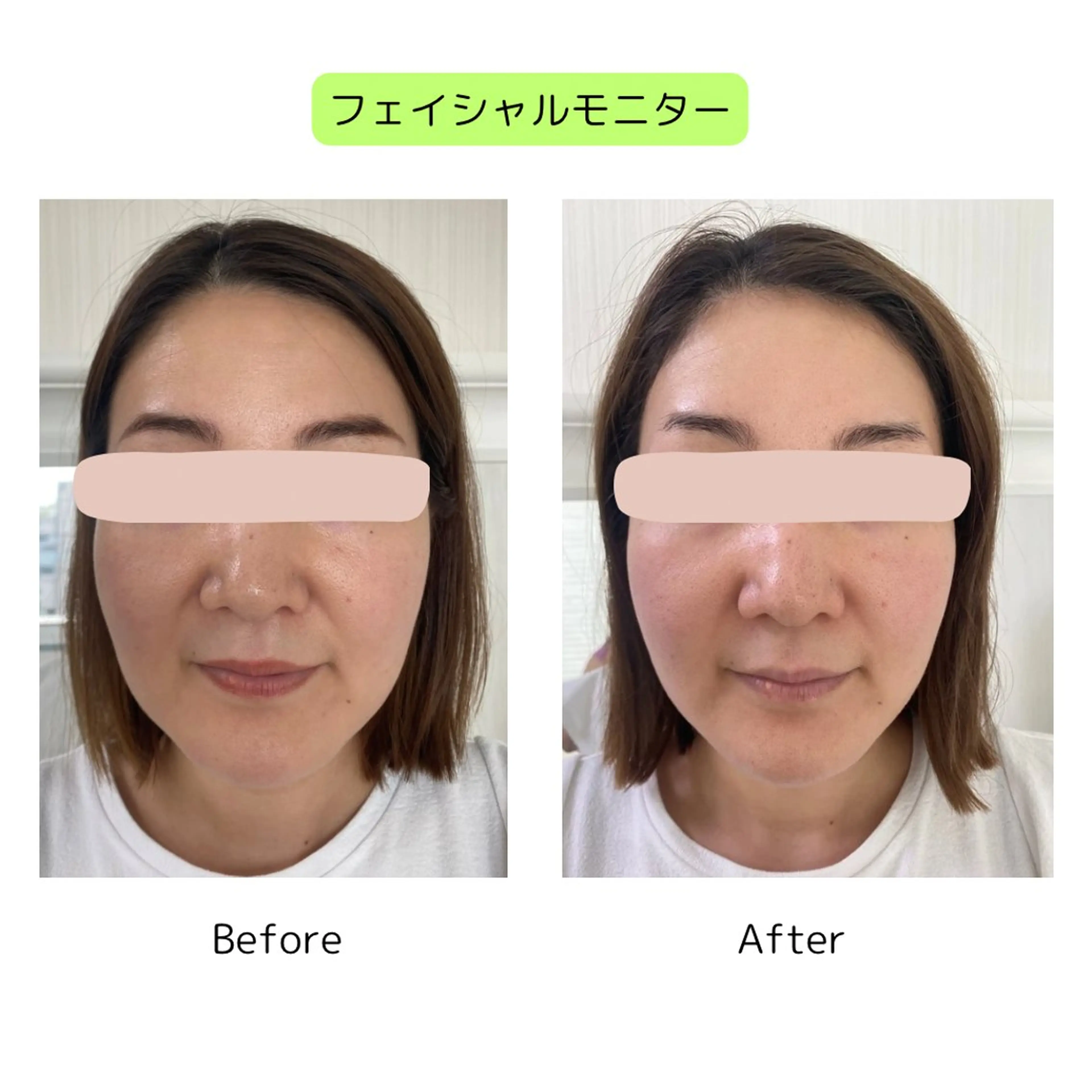 beauty EMELY名古屋のエステ・リラクイメージ