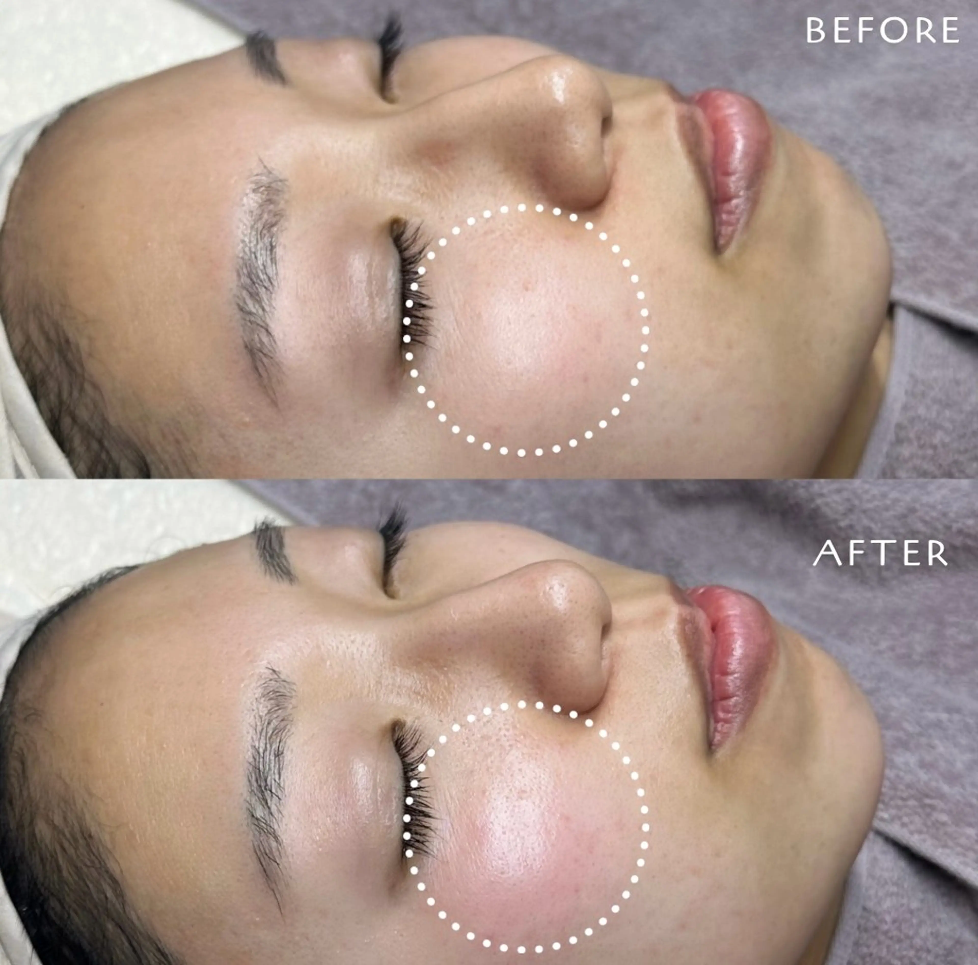 フェイシャルワックス KANAKOのエステ・リラクイメージ