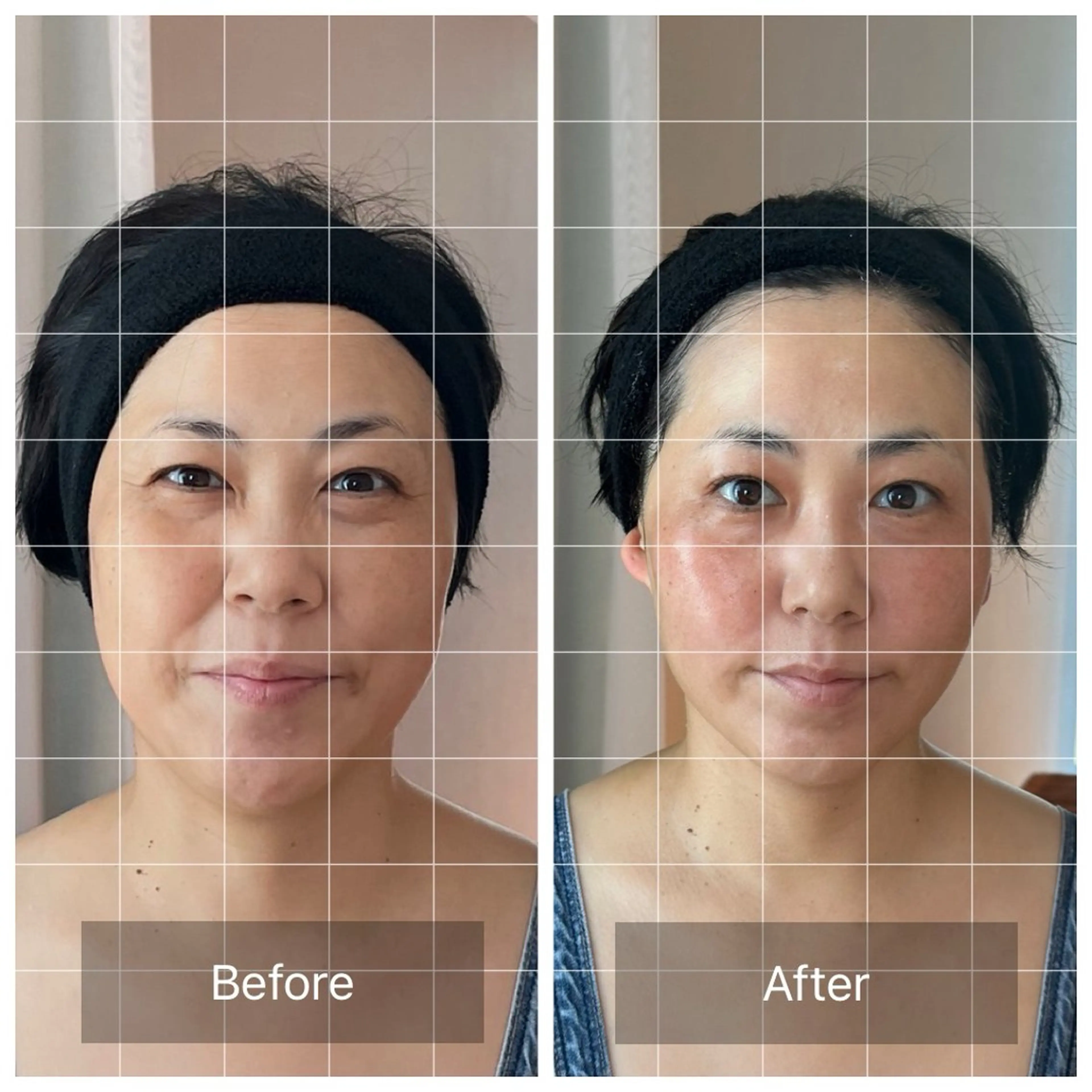 エステ リラク Tanpopo所属・メディカル骨氣サロン Tanpopoのエステ・リラクイメージ