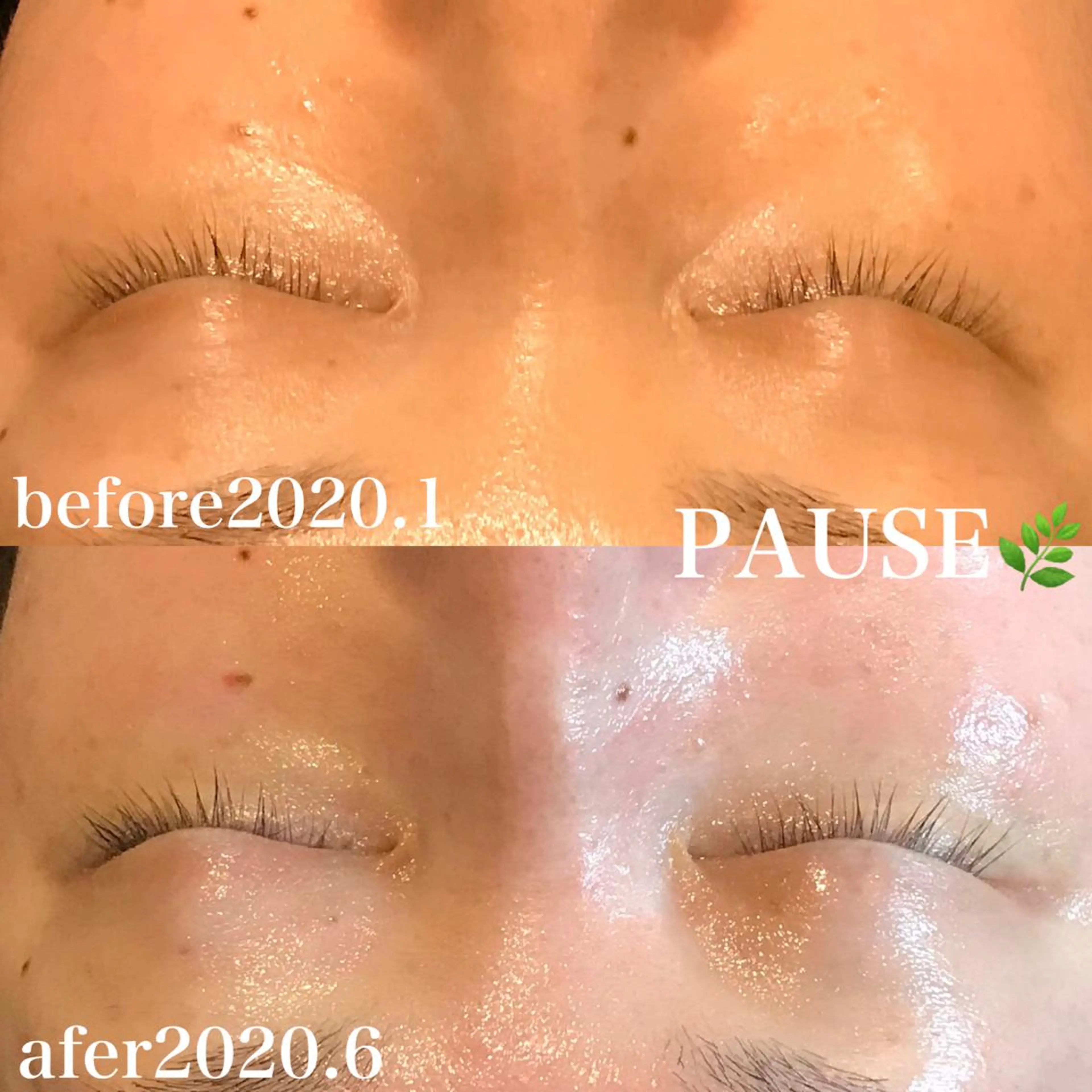 エステ 浜野 恵美のエステ・リラクイメージ