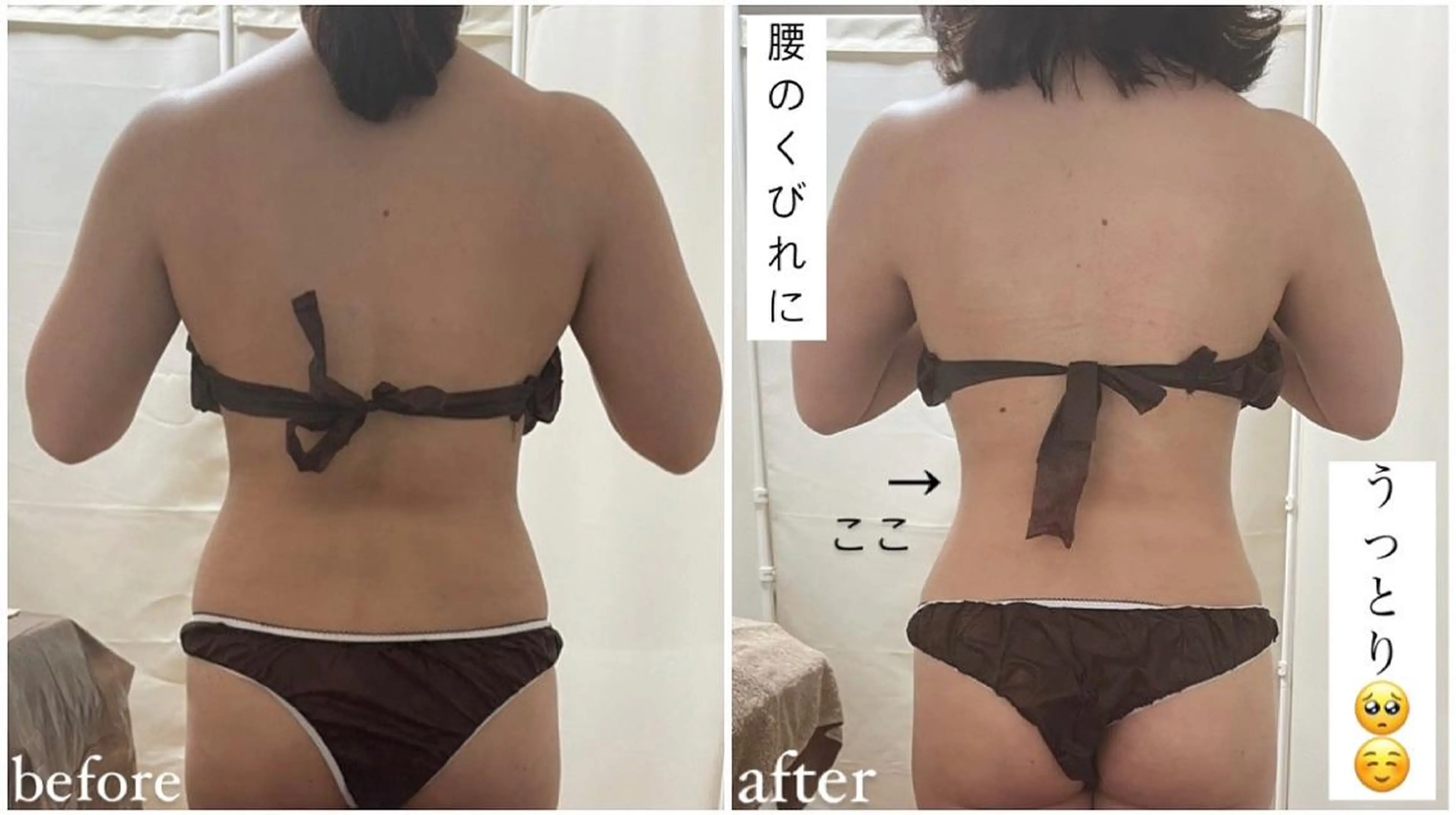 《本気痩せ×疲労改善 》  BILOOPのエステ・リラクイメージ